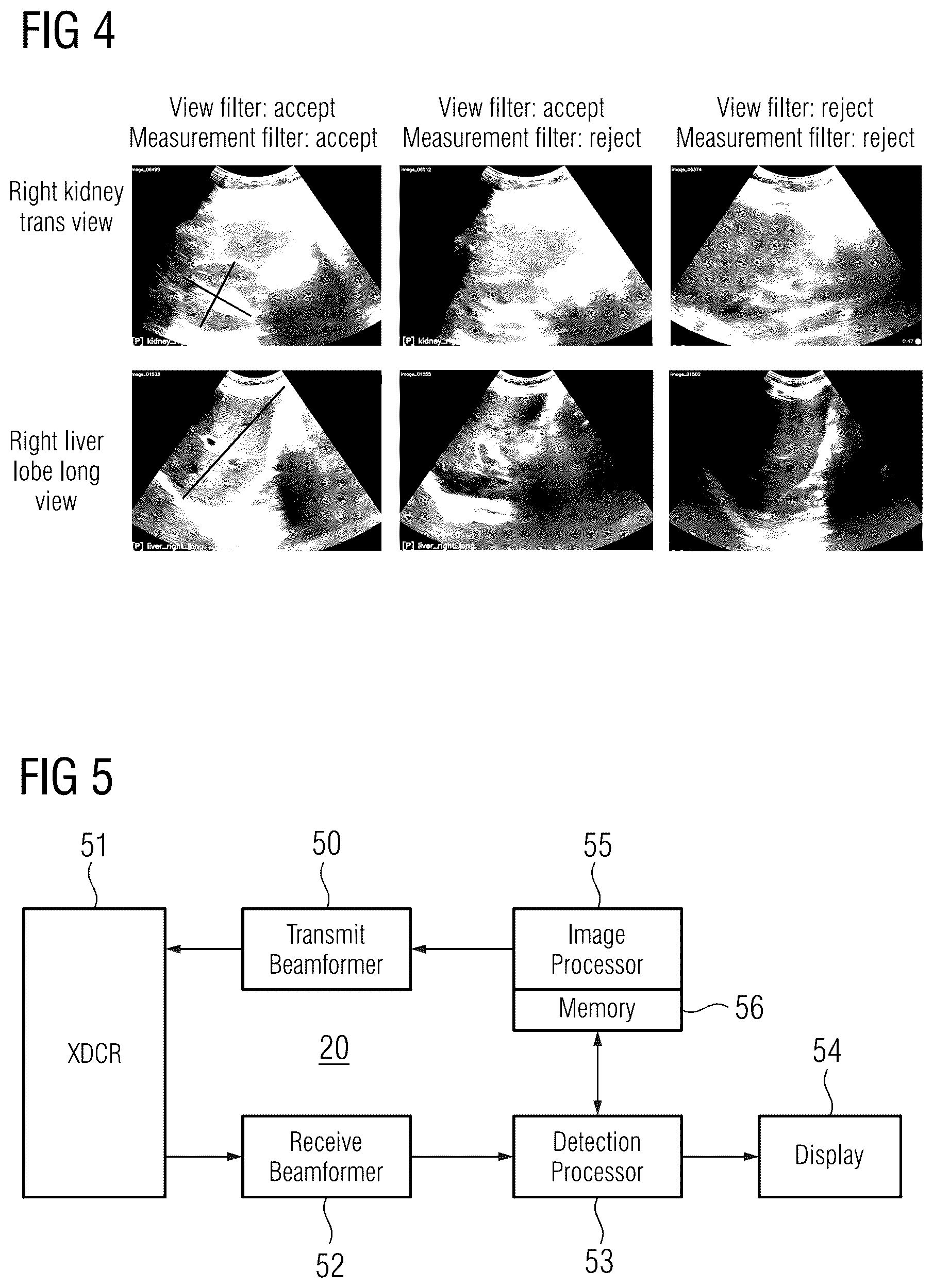 Patent US12616440 Figure 3 – Robust view classification and measurement in ultrasound imaging