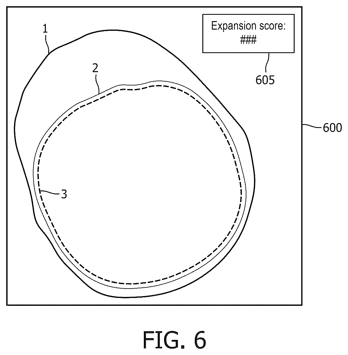 Patent US12616442 Figure 6 – Systems, devices, and methods for coregistration of intravascular data to enhanced stent deployment x-ray images