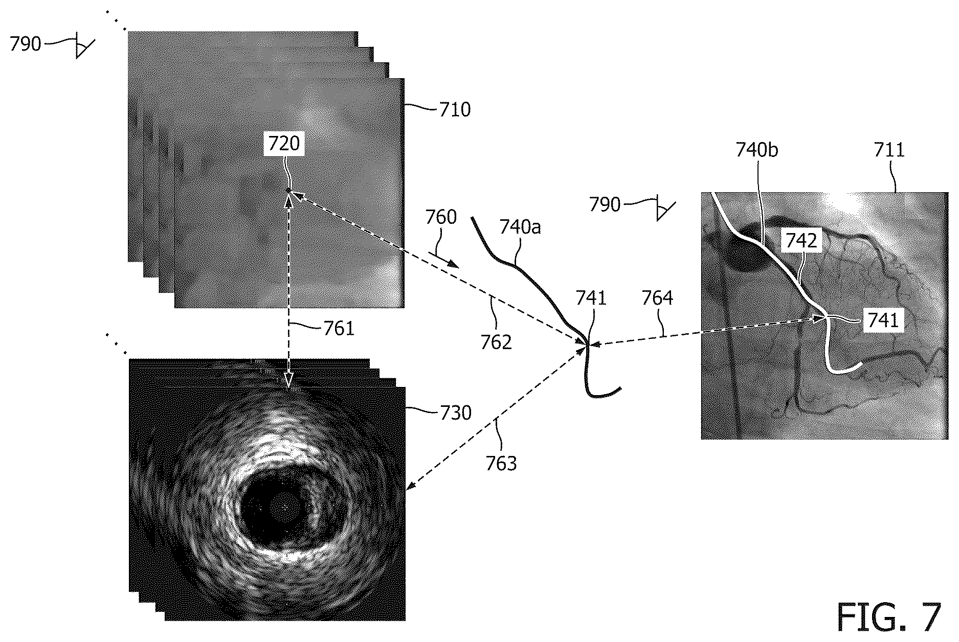 Patent US12616442 Figure 7 – Systems, devices, and methods for coregistration of intravascular data to enhanced stent deployment x-ray images
