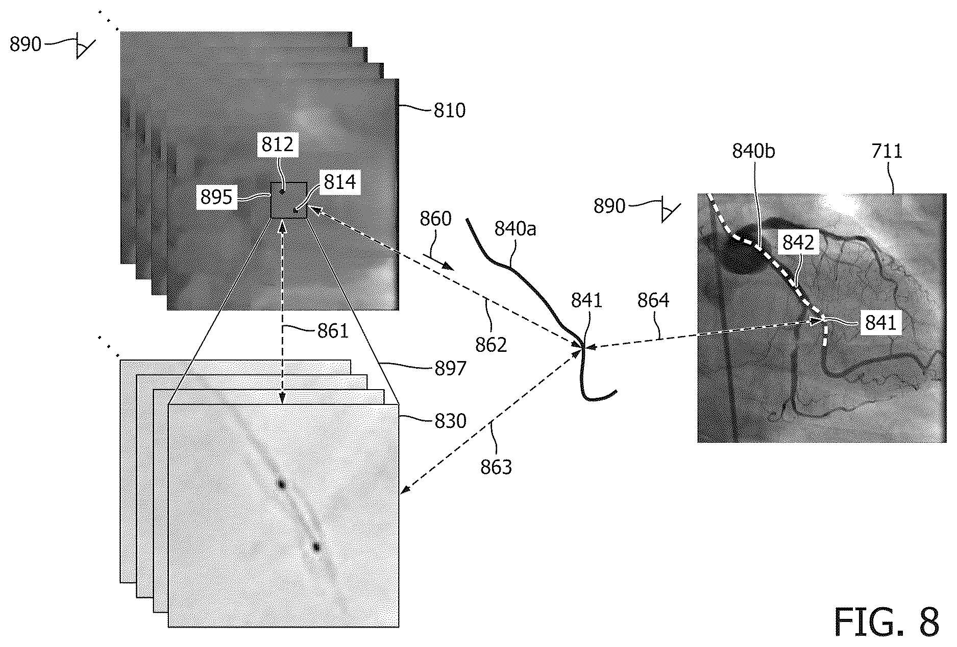 Patent US12616442 Figure 8 – Systems, devices, and methods for coregistration of intravascular data to enhanced stent deployment x-ray images