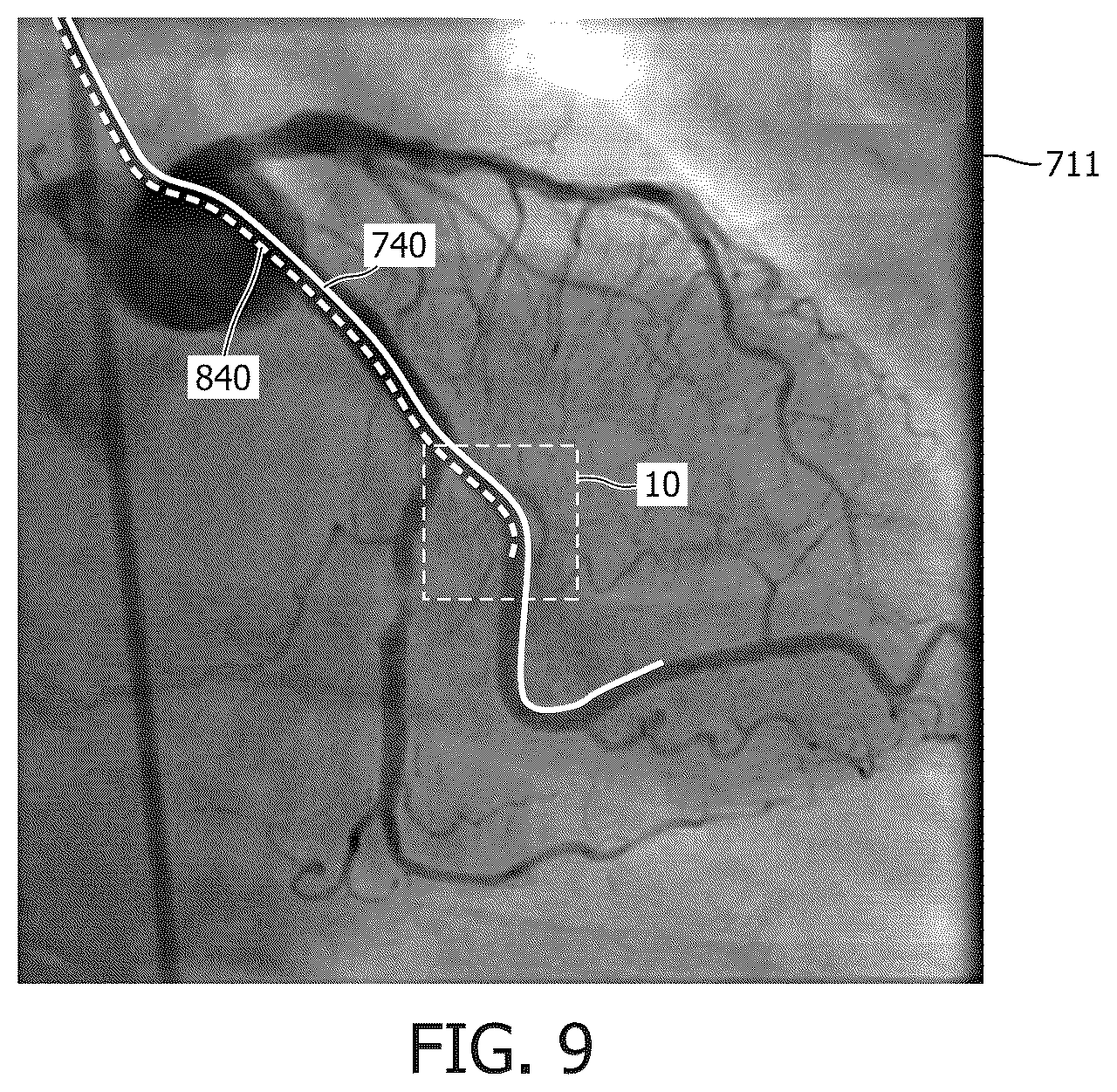 Patent US12616442 Figure 9 – Systems, devices, and methods for coregistration of intravascular data to enhanced stent deployment x-ray images