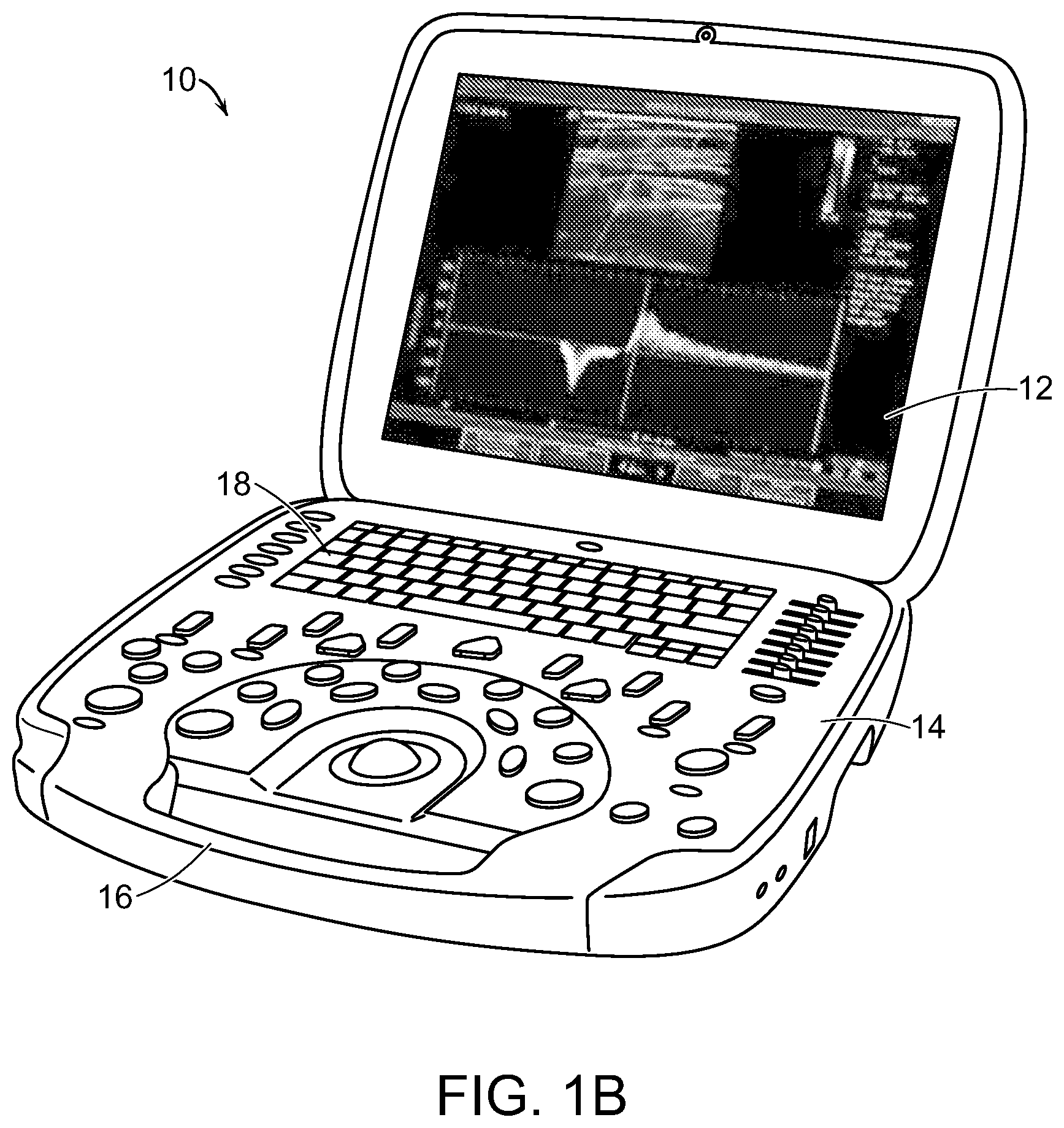 Patent US12616445 Figure 2 – Portable ultrasound system