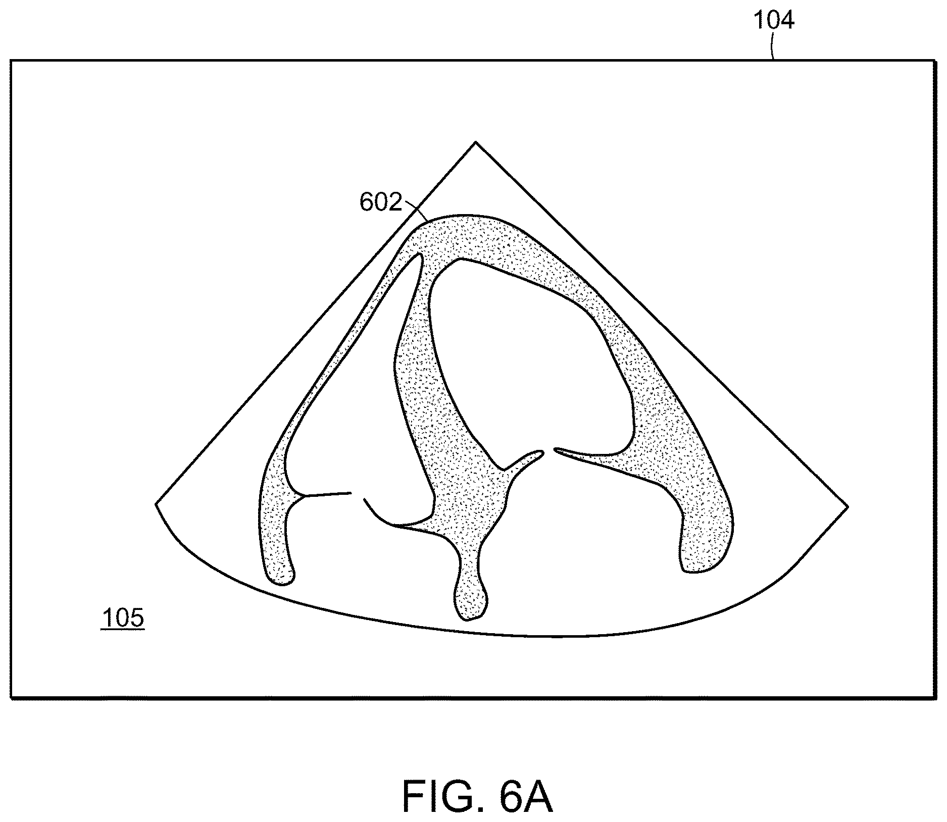 Patent US12616445 Figure 11 – Portable ultrasound system