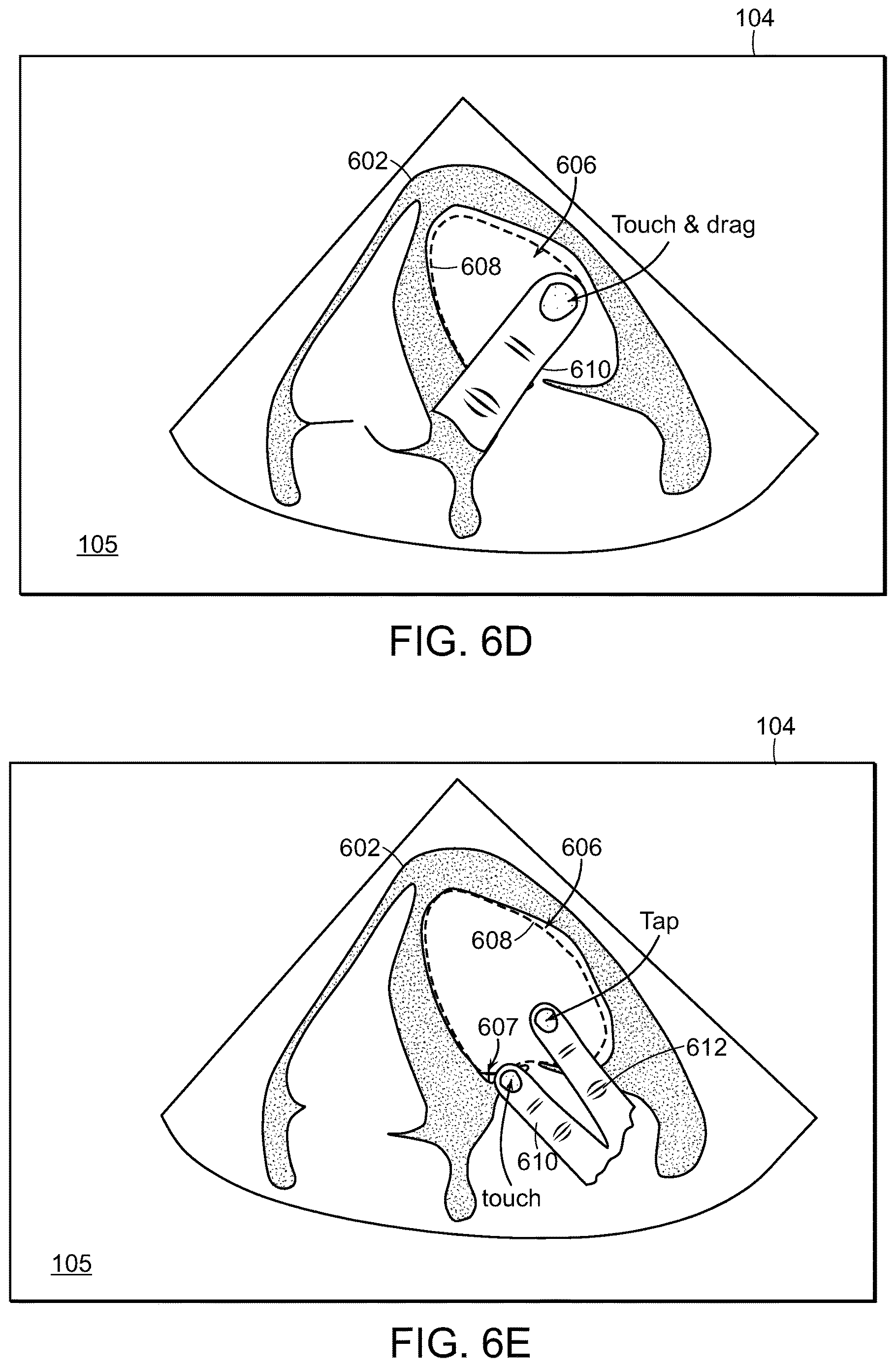 Patent US12616445 Figure 13 – Portable ultrasound system