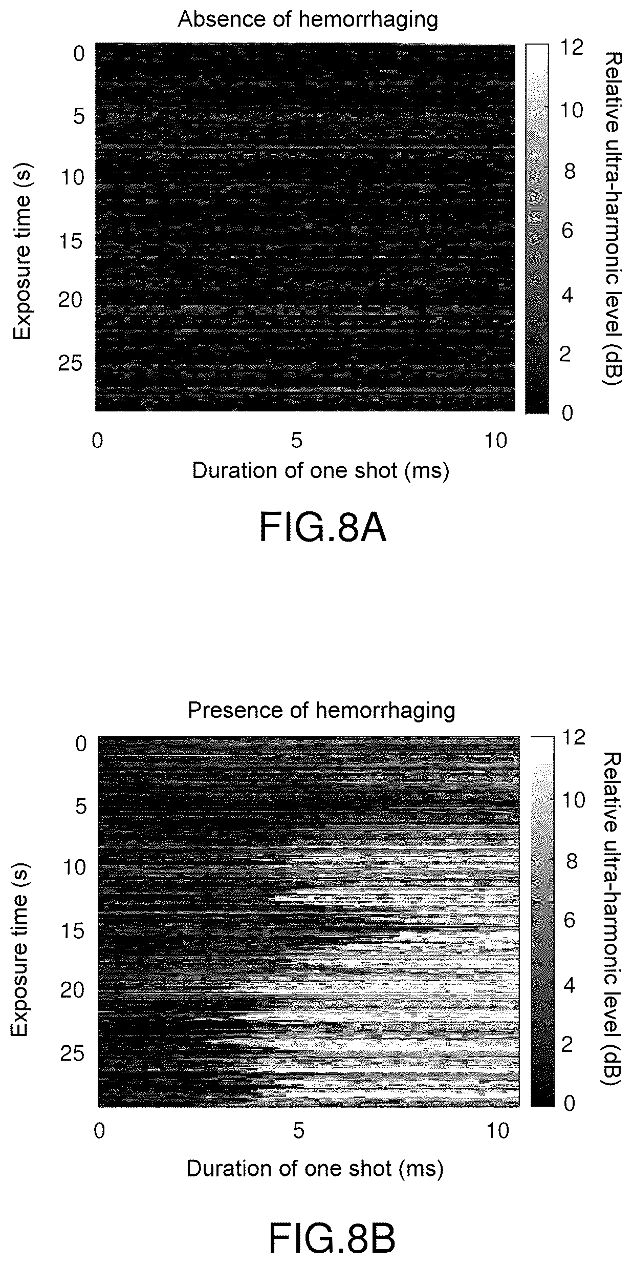 Patent US12616447 Figure 6 – Method and system for spectral analysis and determination of a marker making it possible to ensure the safety of therapeutic ultrasound interventions