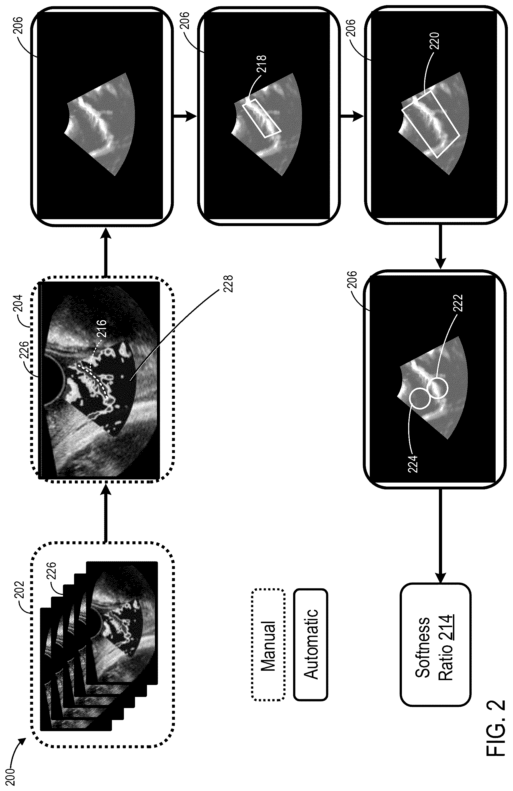 Patent US12616448 Figure 2 – Methods and systems for automated analysis of cervix elastography