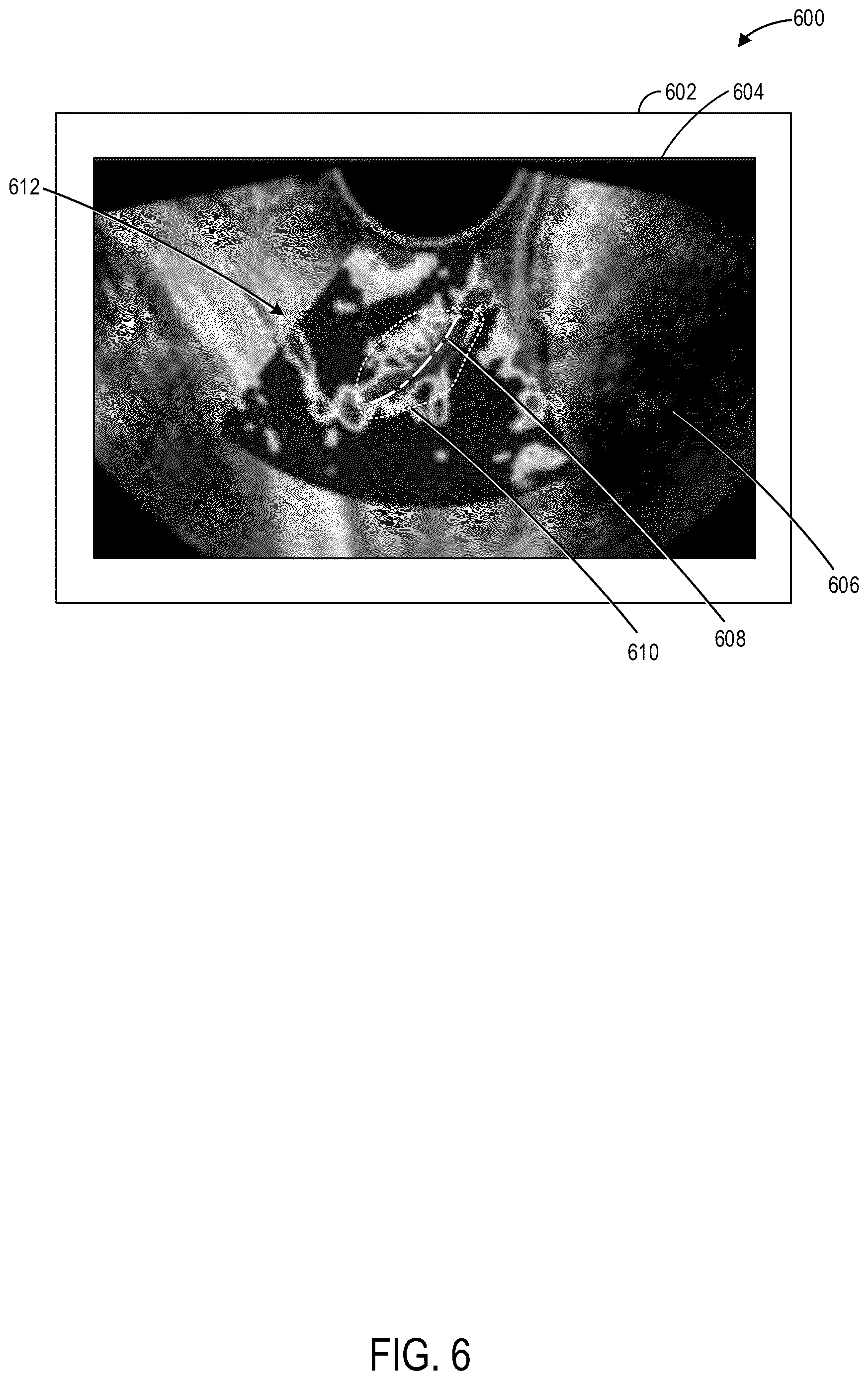 Patent US12616448 Figure 6 – Methods and systems for automated analysis of cervix elastography