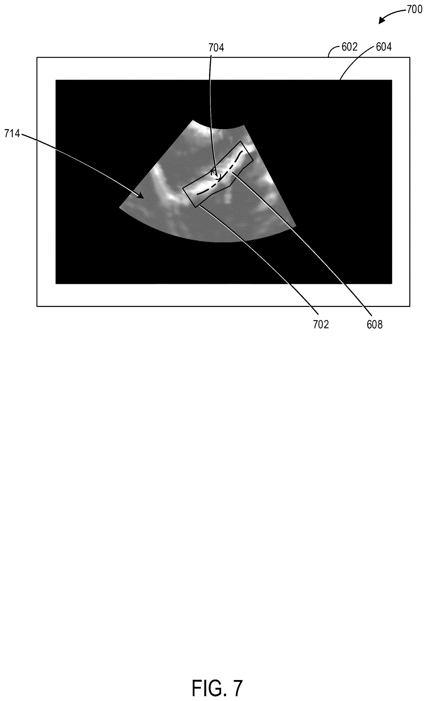 Patent US12616448 Figure 7 – Methods and systems for automated analysis of cervix elastography