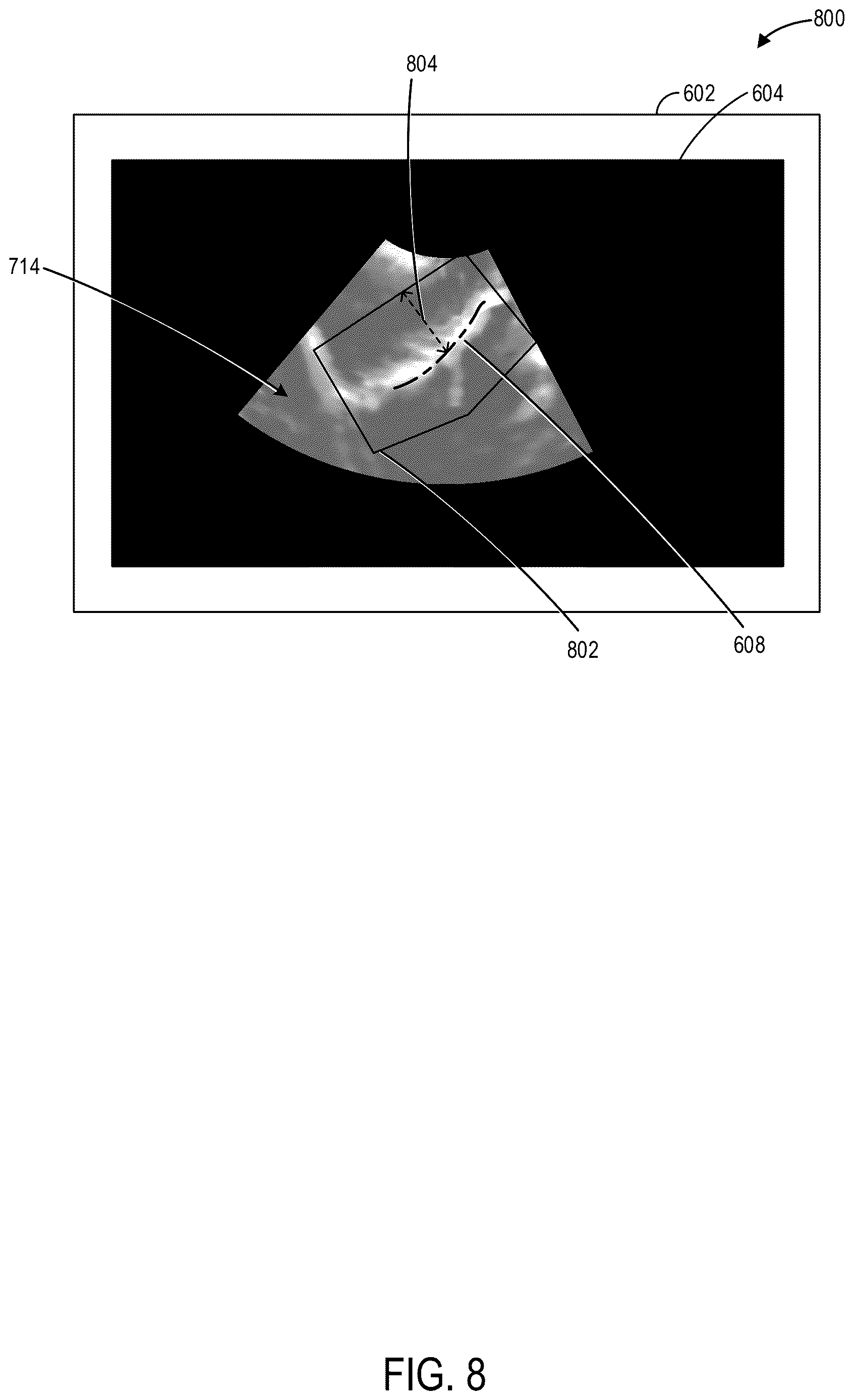 Patent US12616448 Figure 8 – Methods and systems for automated analysis of cervix elastography