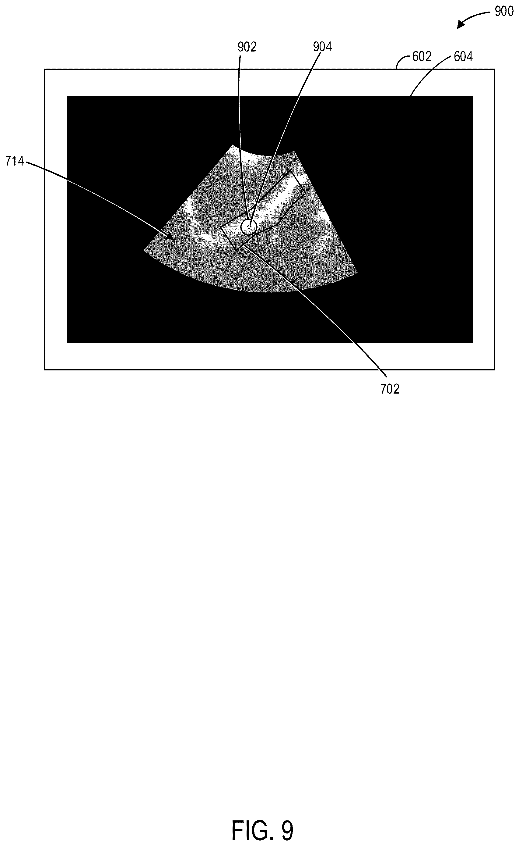 Patent US12616448 Figure 9 – Methods and systems for automated analysis of cervix elastography