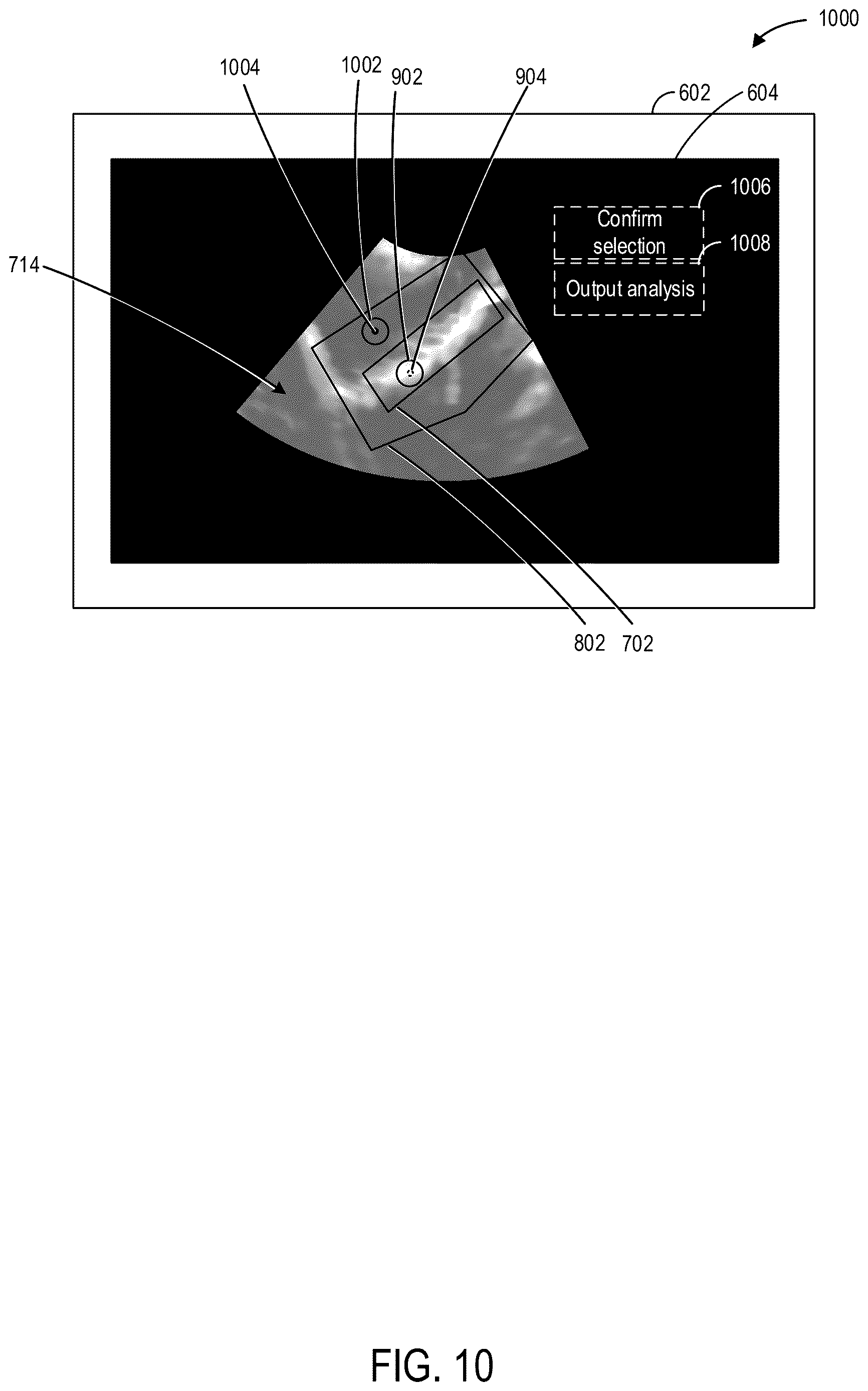 Patent US12616448 Figure 10 – Methods and systems for automated analysis of cervix elastography