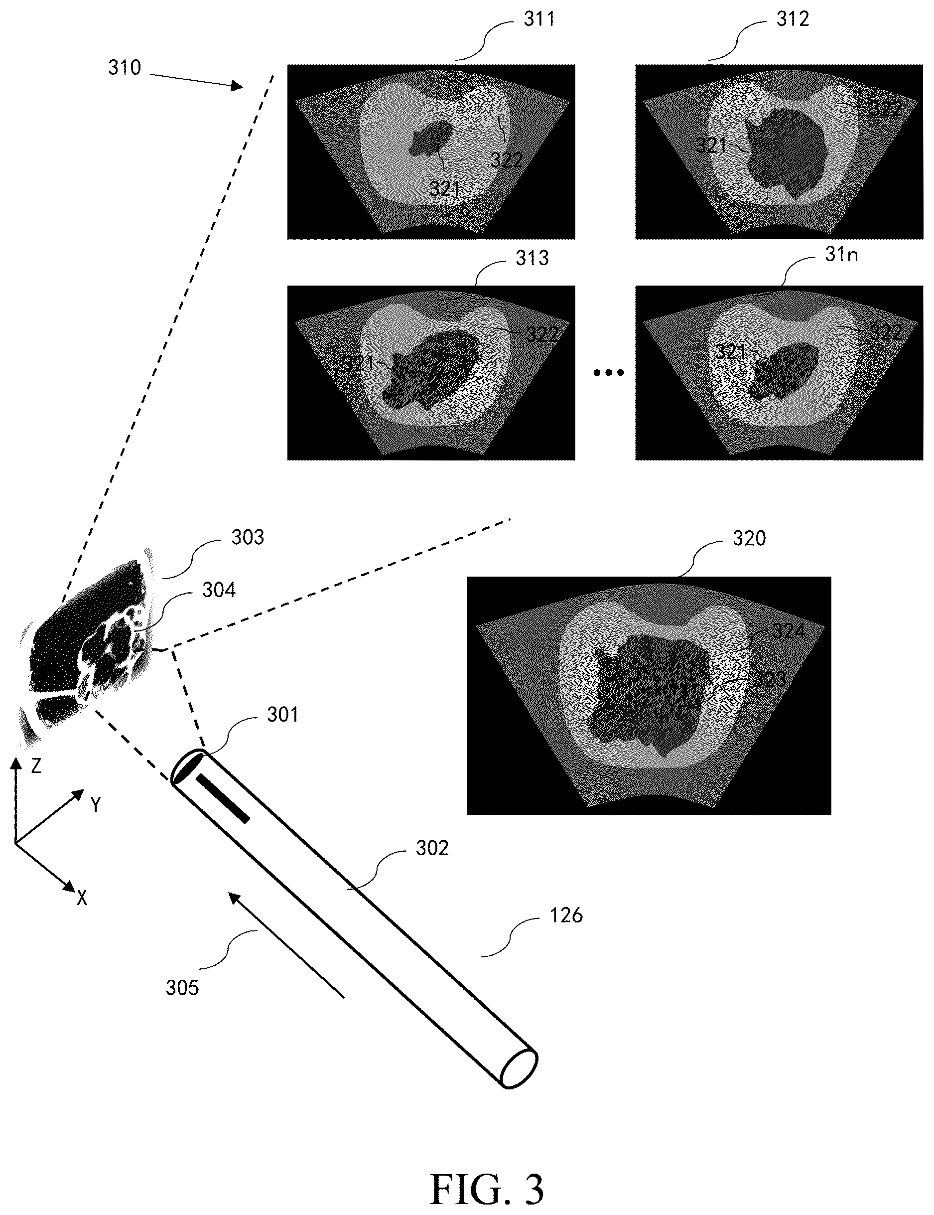 Patent US12616449 Figure 3 – Ultrasonic imaging system, and non-transitory computer-readable medium