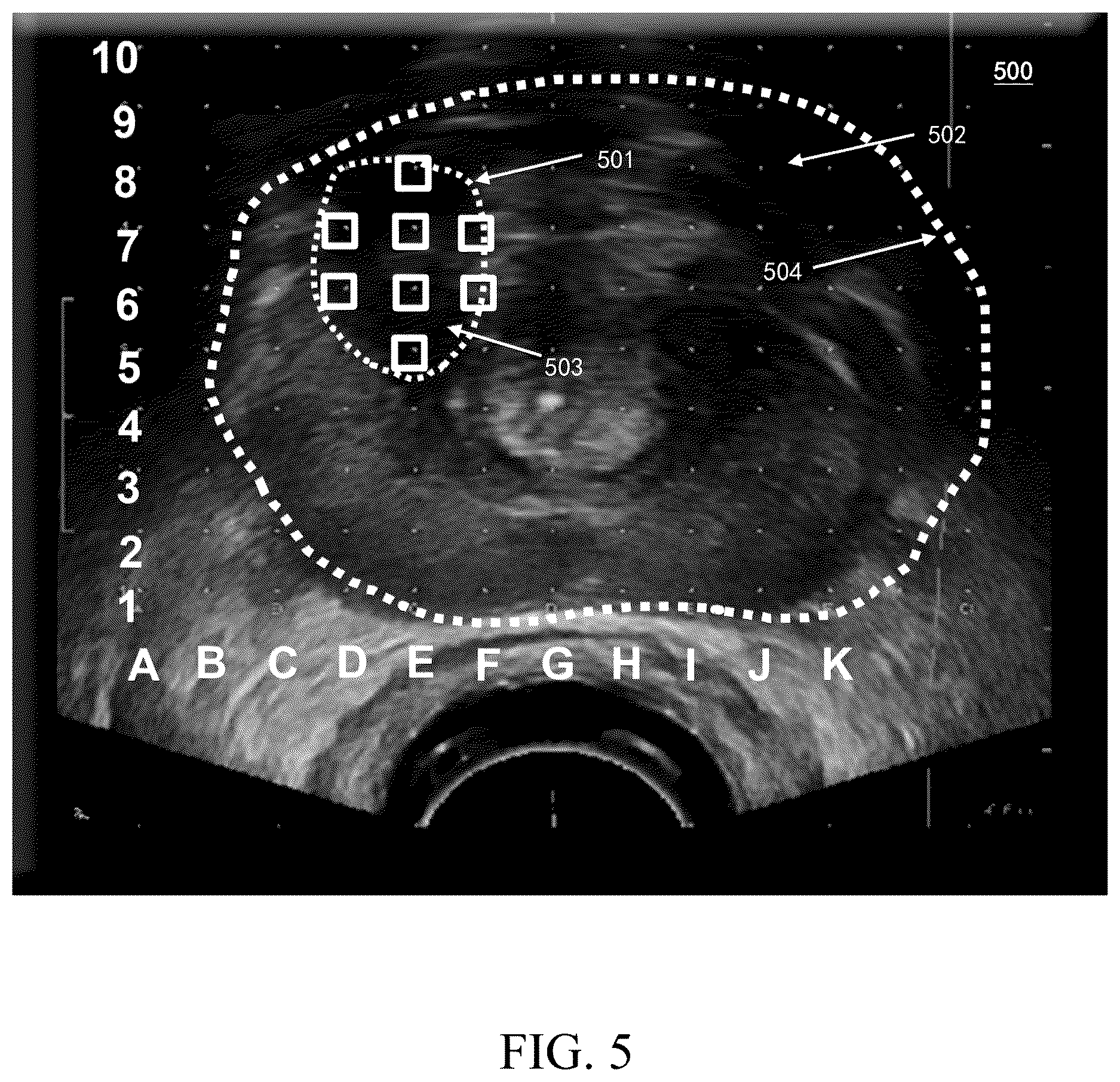 Patent US12616449 Figure 5 – Ultrasonic imaging system, and non-transitory computer-readable medium
