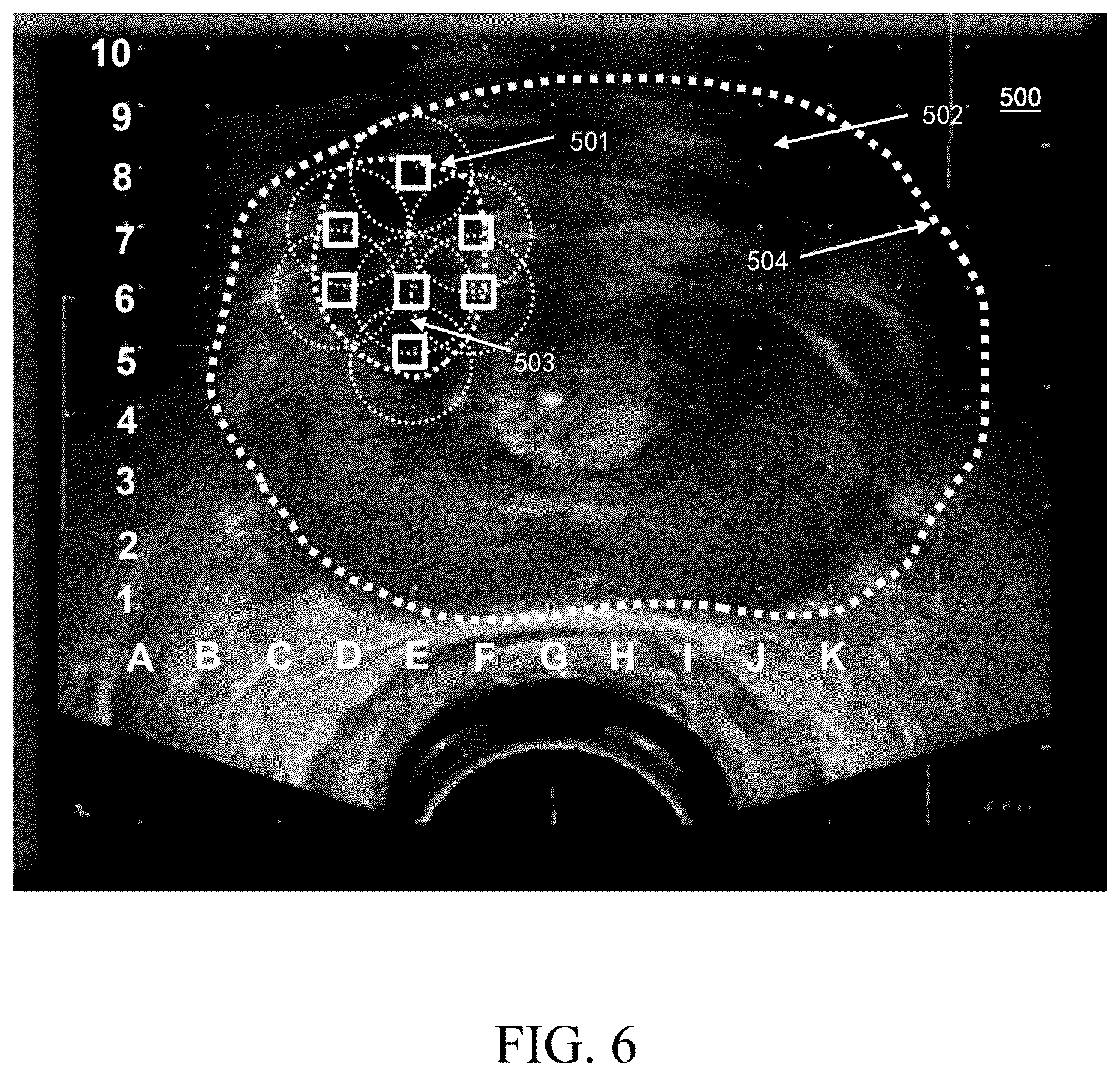 Patent US12616449 Figure 6 – Ultrasonic imaging system, and non-transitory computer-readable medium