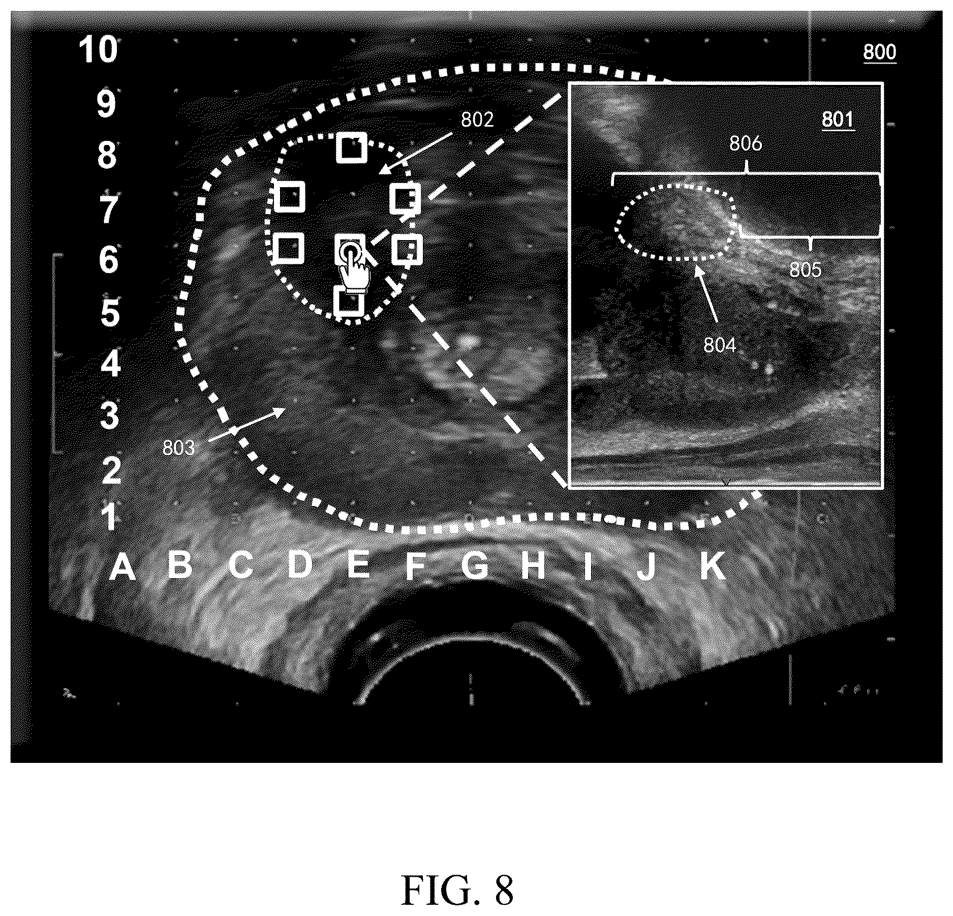 Patent US12616449 Figure 8 – Ultrasonic imaging system, and non-transitory computer-readable medium