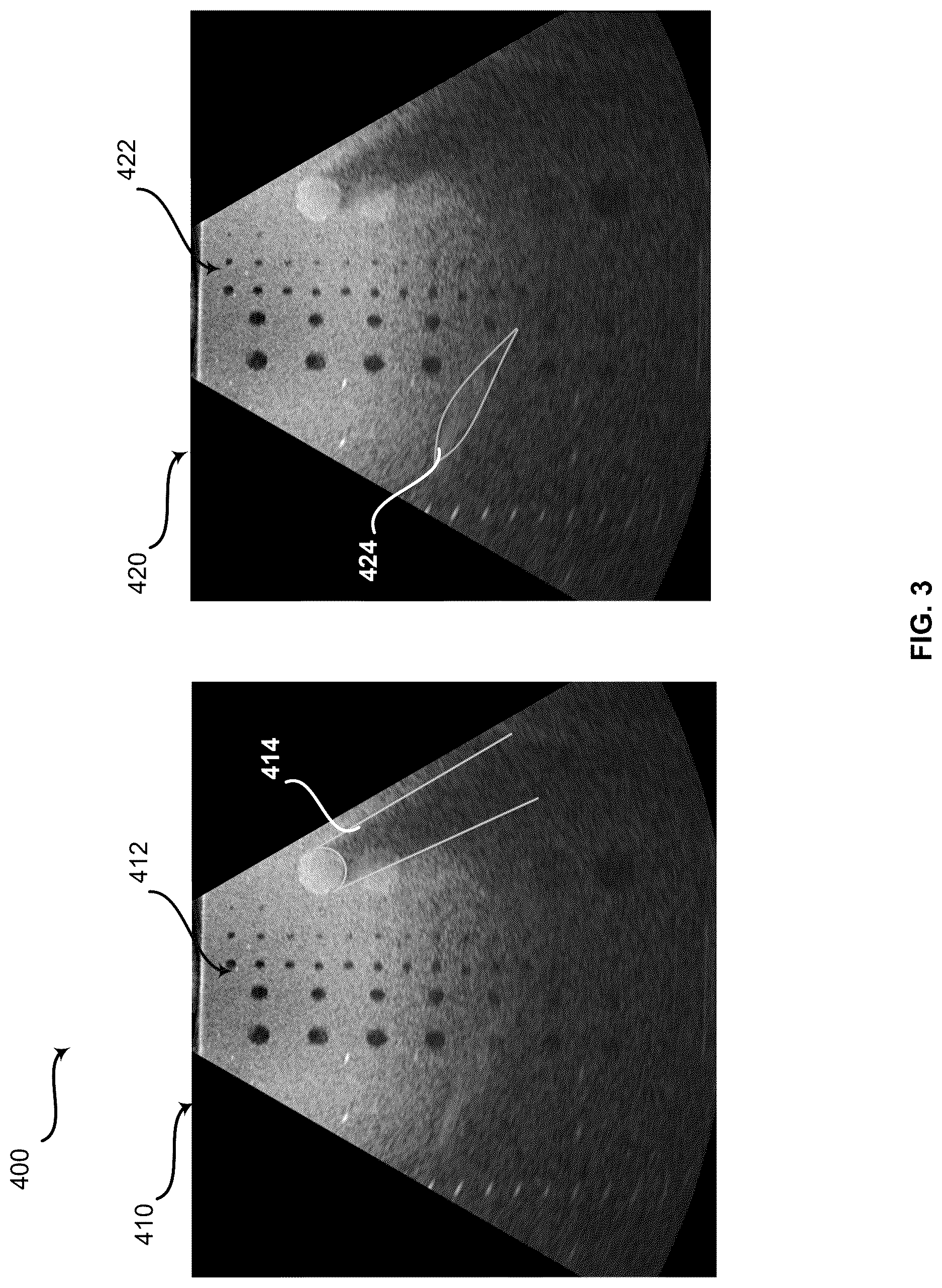 Patent US12616451 Figure 3 – Method and system for artifact reduction by movement detection