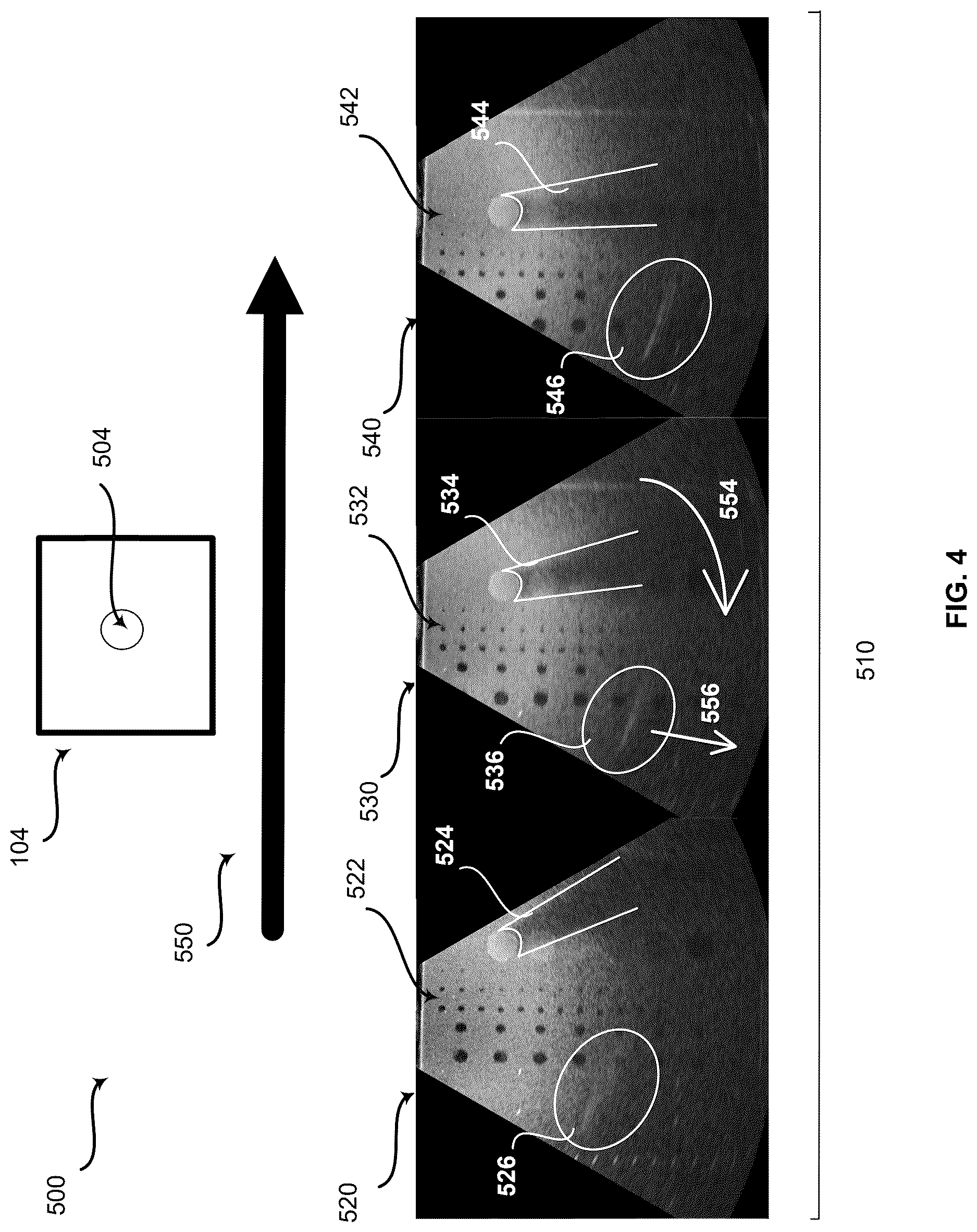 Patent US12616451 Figure 4 – Method and system for artifact reduction by movement detection