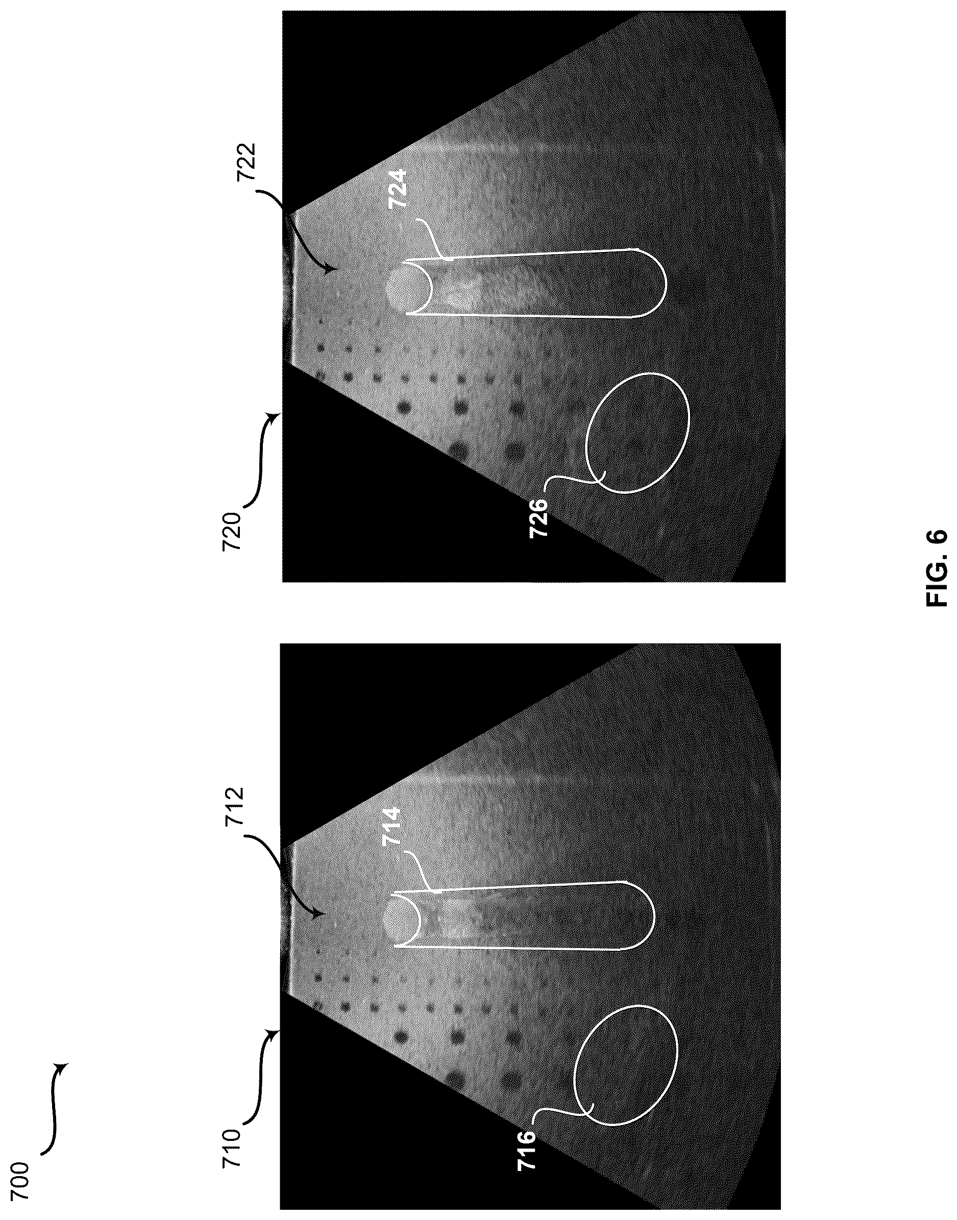 Patent US12616451 Figure 6 – Method and system for artifact reduction by movement detection