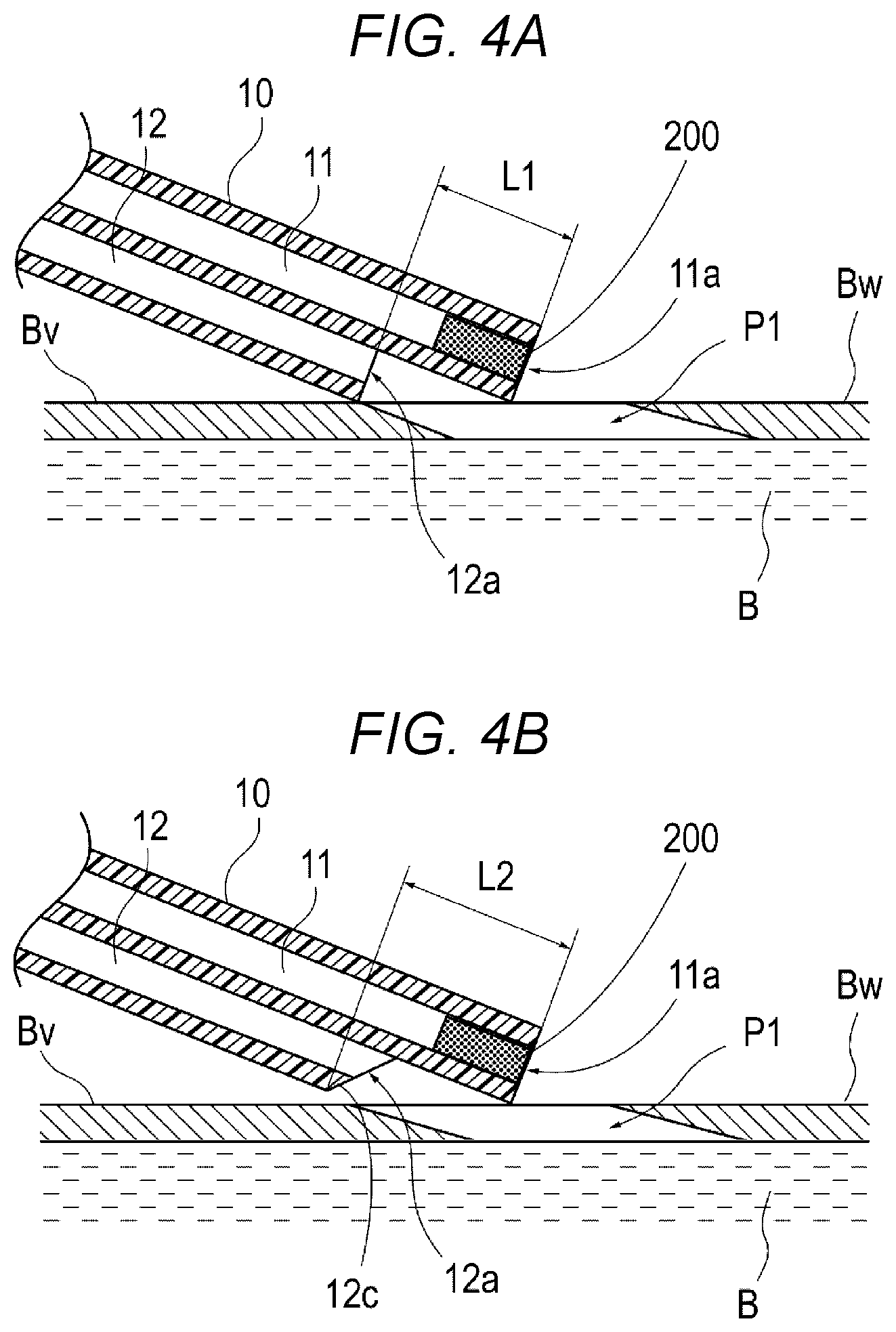Patent US12616458 Figure 4 – Adhesive material injection device