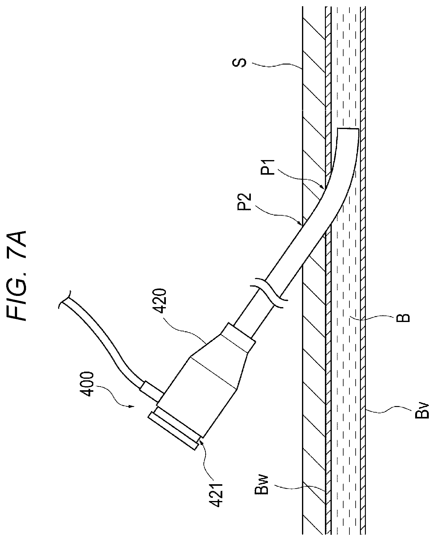 Patent US12616458 Figure 7 – Adhesive material injection device