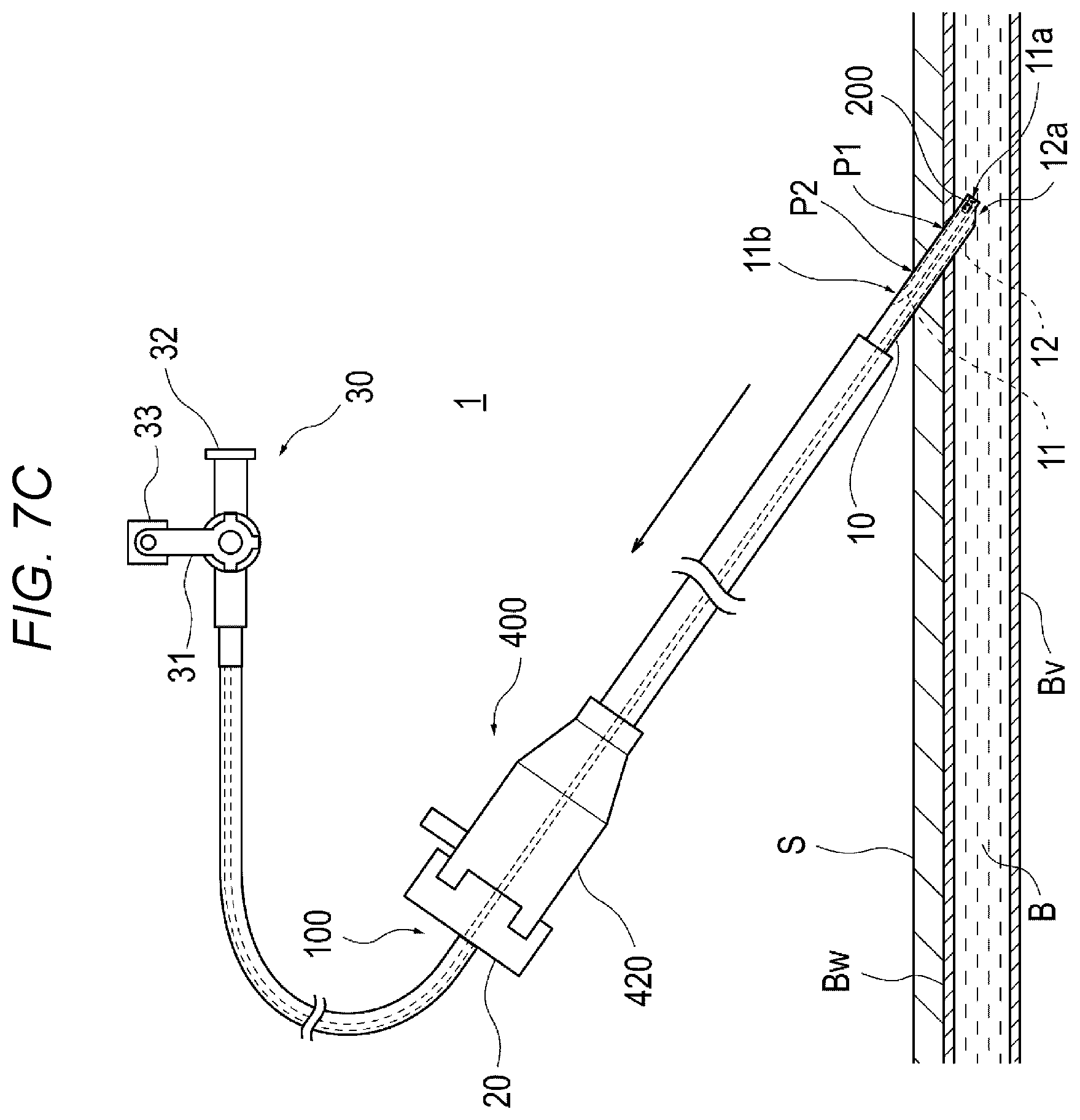 Patent US12616458 Figure 9 – Adhesive material injection device