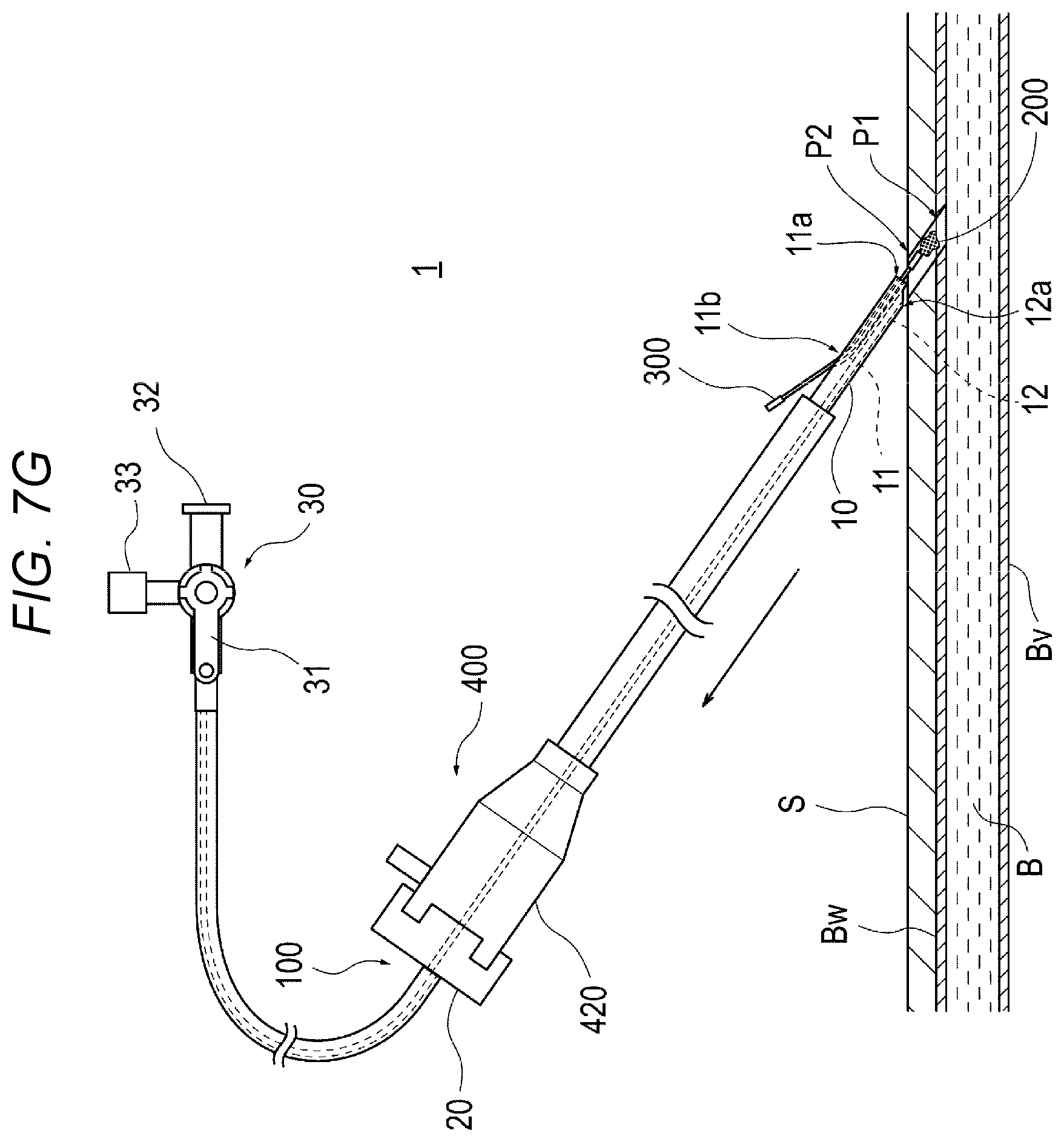 Patent US12616458 Figure 13 – Adhesive material injection device