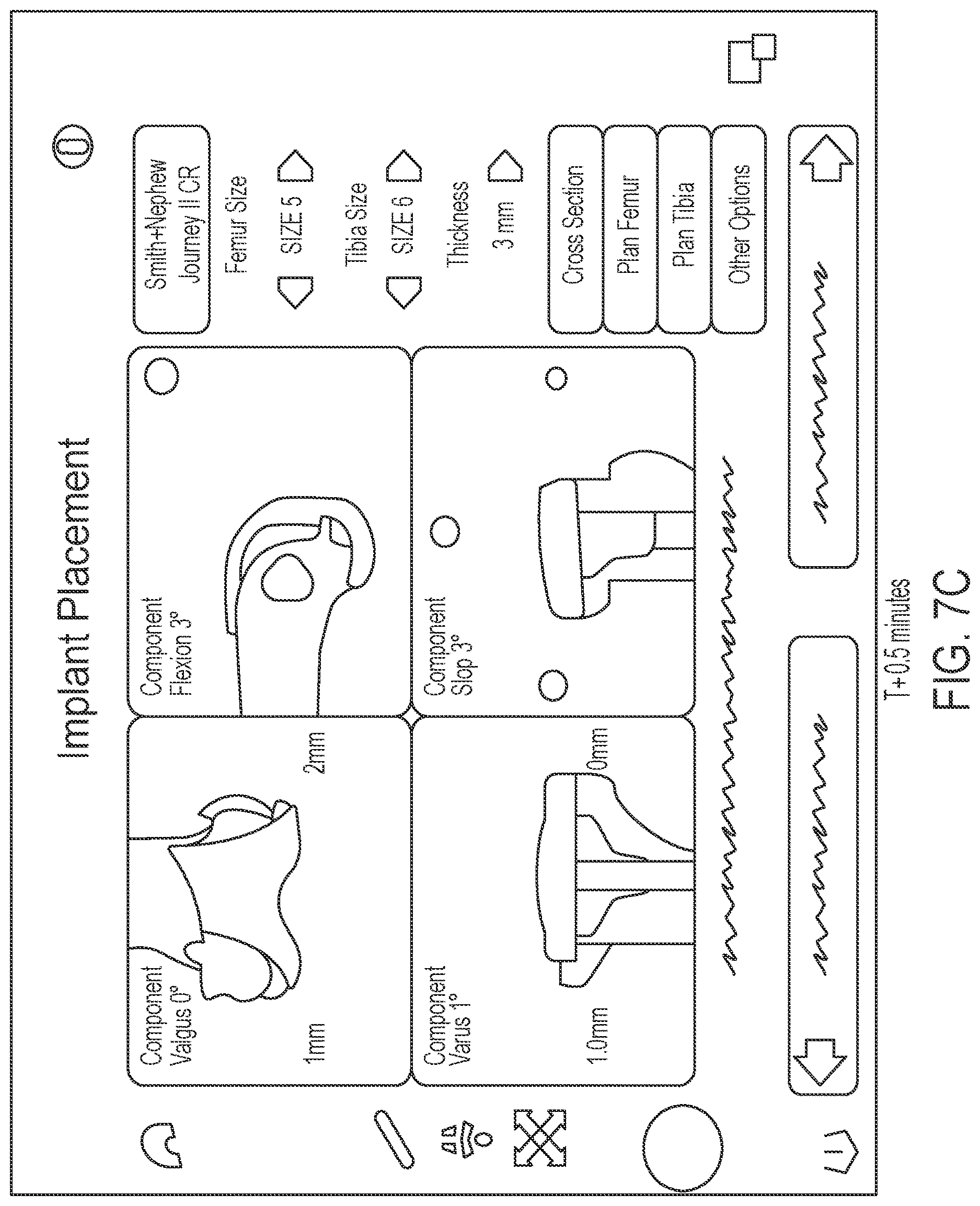 Patent US12616460 Figure 11 – Knee tensioner with digital force and displacement sensing