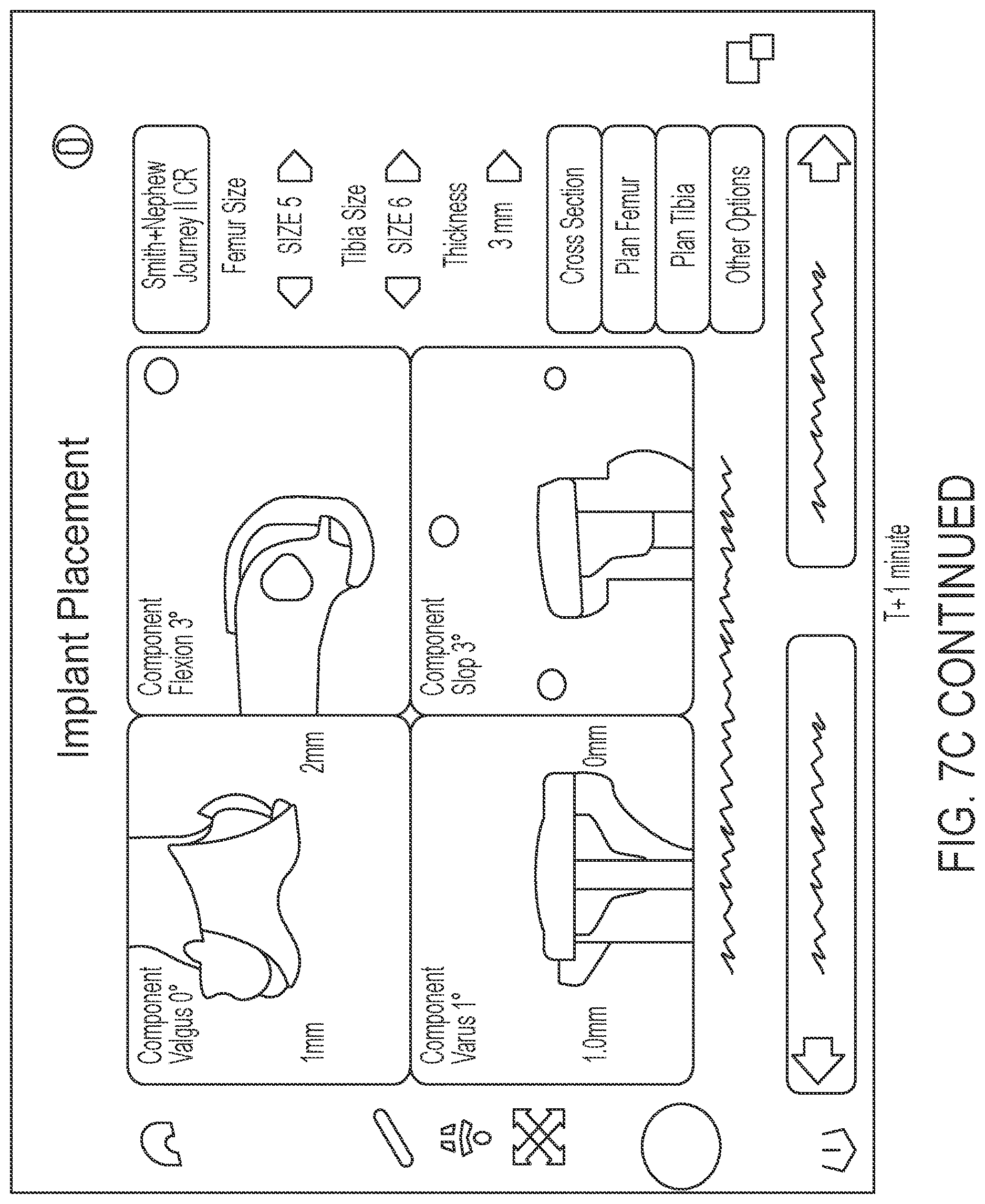 Patent US12616460 Figure 12 – Knee tensioner with digital force and displacement sensing