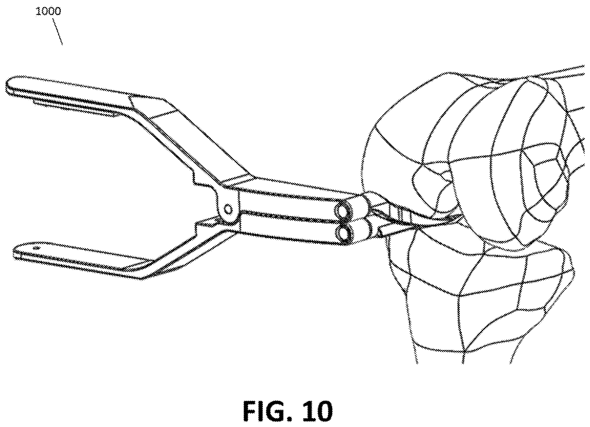 Patent US12616460 Figure 18 – Knee tensioner with digital force and displacement sensing