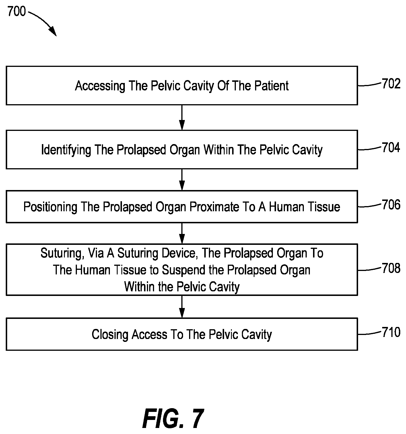 Patent US12616461 Figure 6 – Method of suturing a prosthetic to human tissue