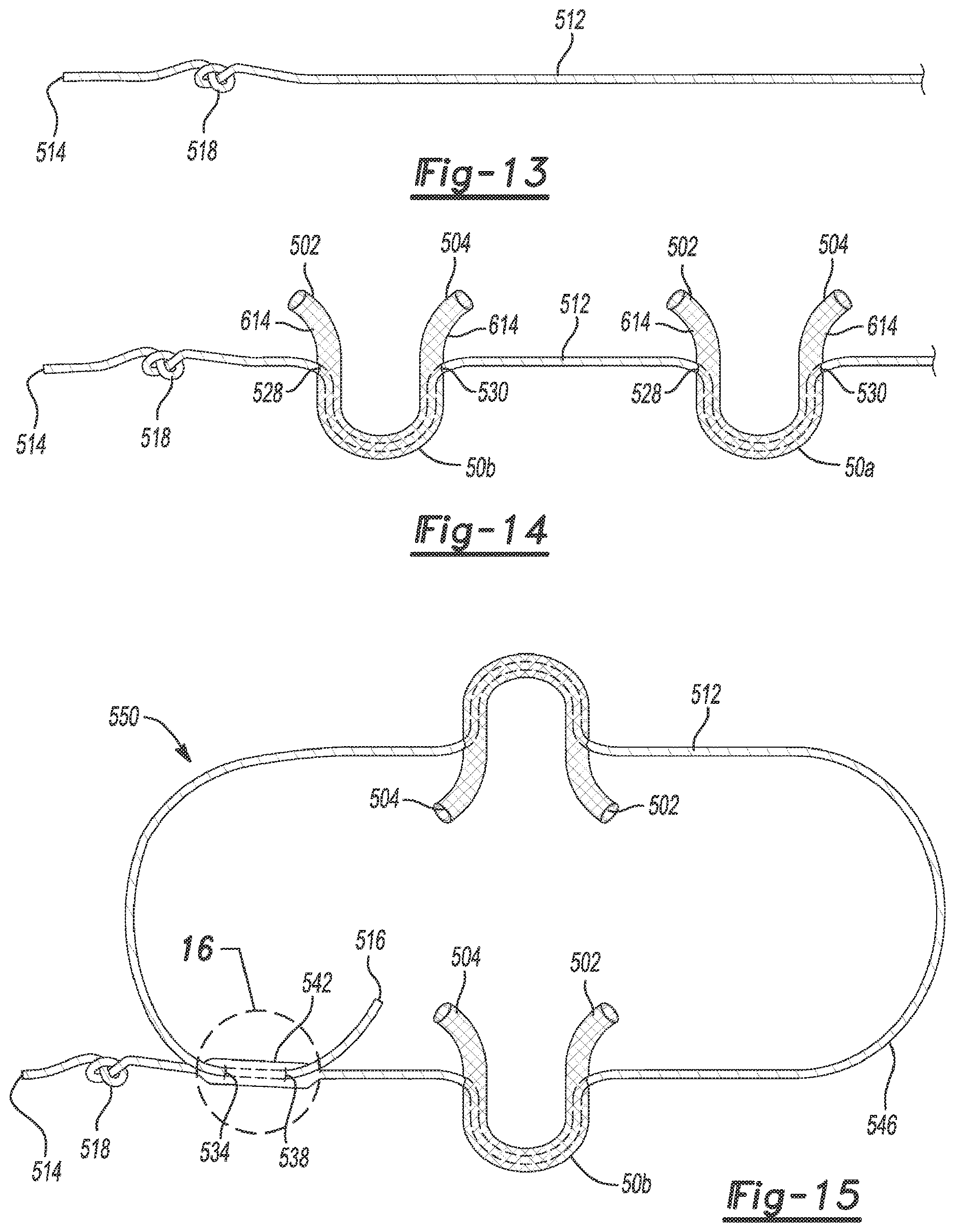Patent US12616462 Figure 13 – Soft tissue repair device and method