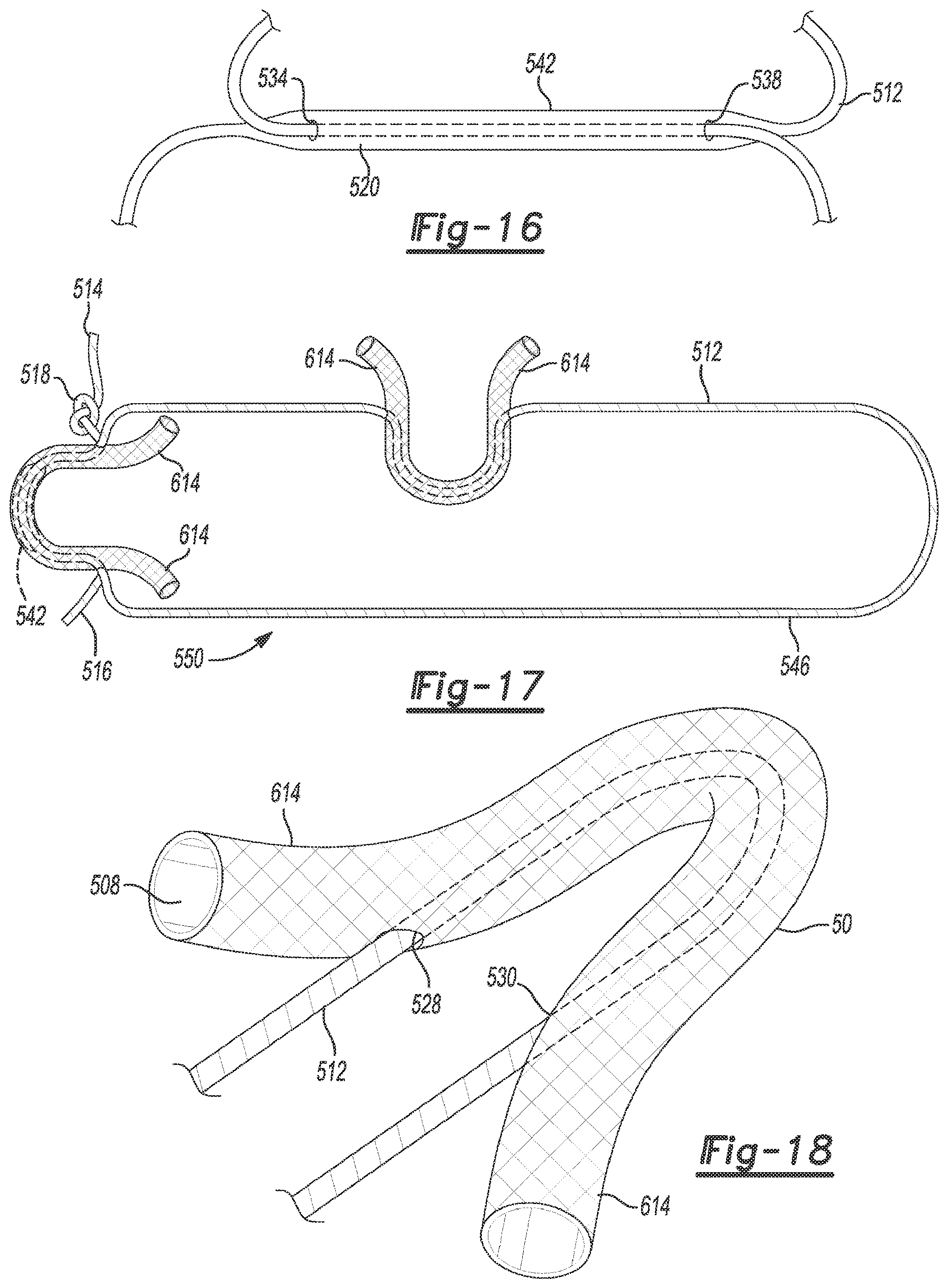 Patent US12616462 Figure 14 – Soft tissue repair device and method
