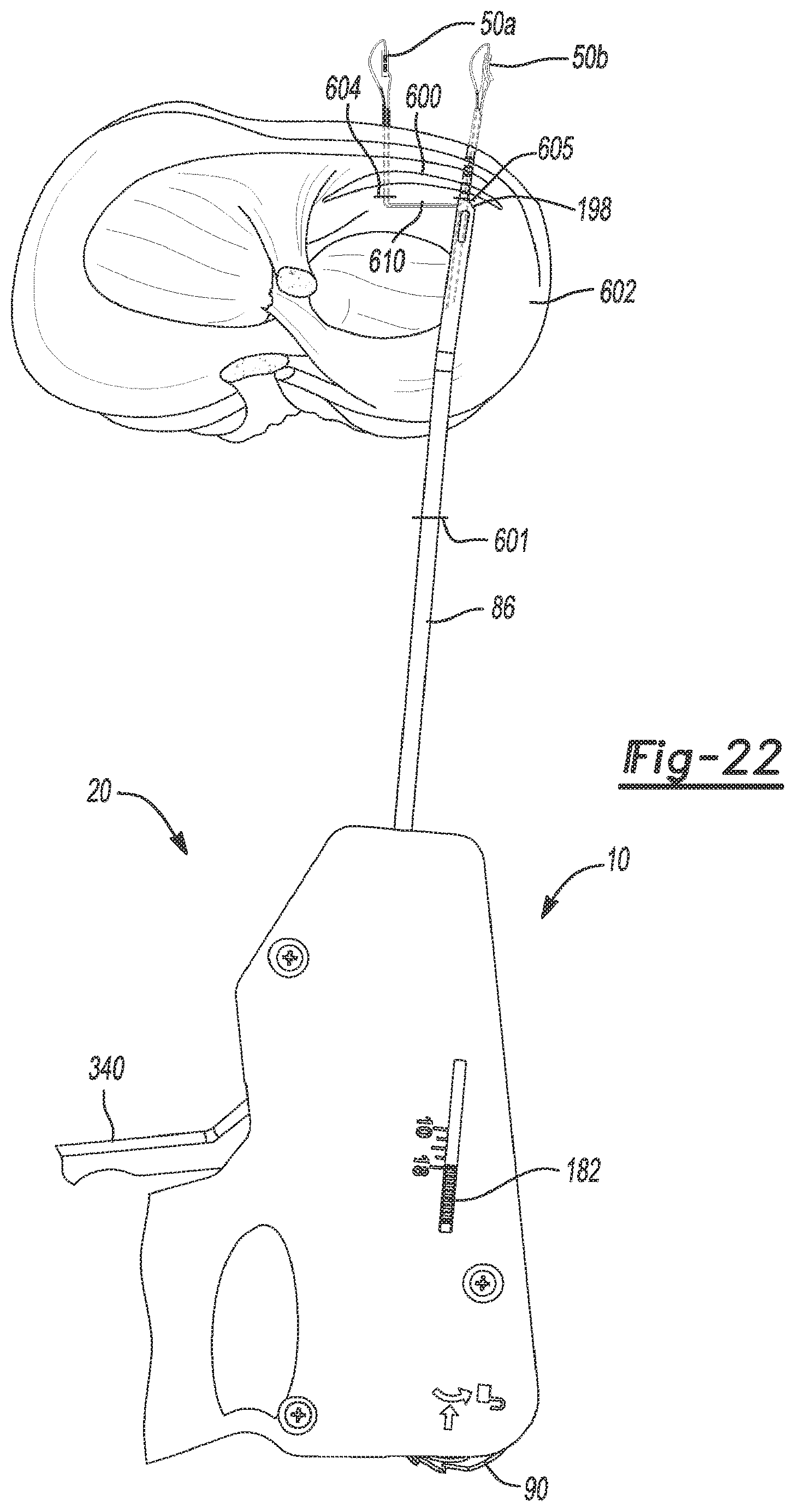 Patent US12616462 Figure 18 – Soft tissue repair device and method