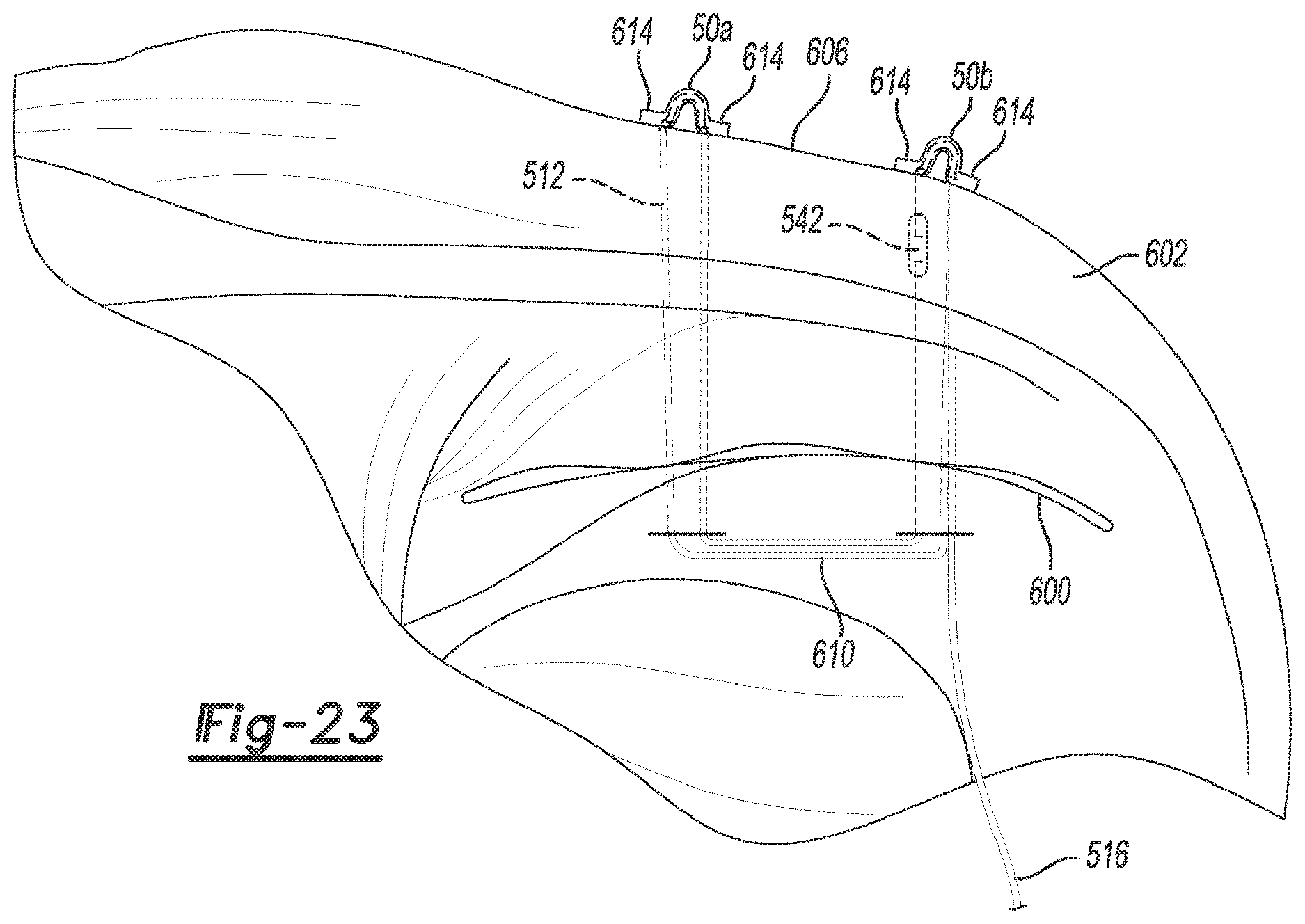 Patent US12616462 Figure 19 – Soft tissue repair device and method