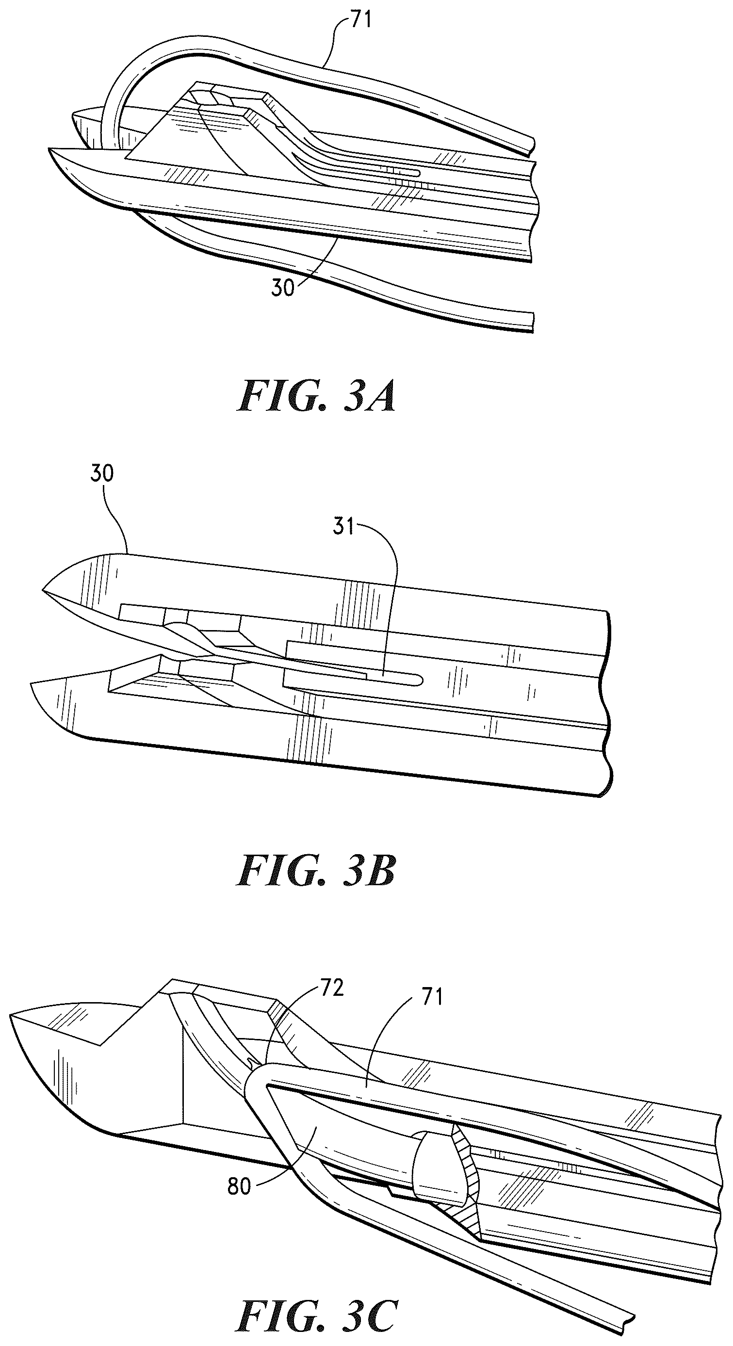 Patent US12616463 Figure 3 – Multi-function systems, apparatus and methods for approximating, ligating and fixating soft tissue