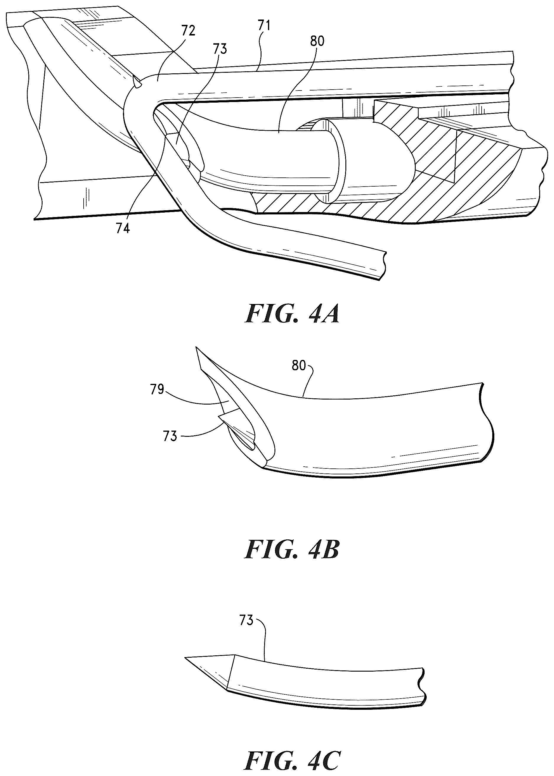 Patent US12616463 Figure 4 – Multi-function systems, apparatus and methods for approximating, ligating and fixating soft tissue