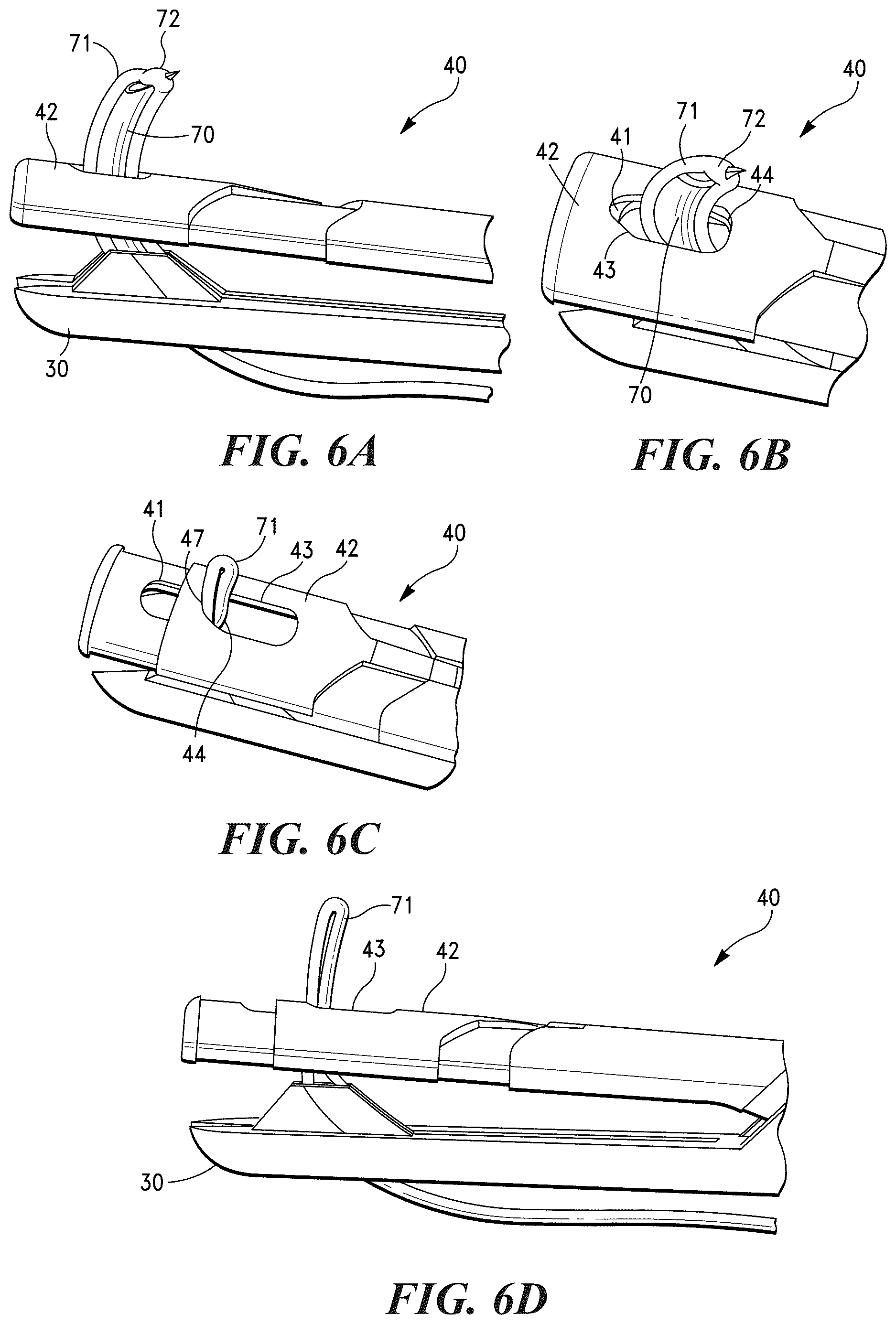 Patent US12616463 Figure 6 – Multi-function systems, apparatus and methods for approximating, ligating and fixating soft tissue