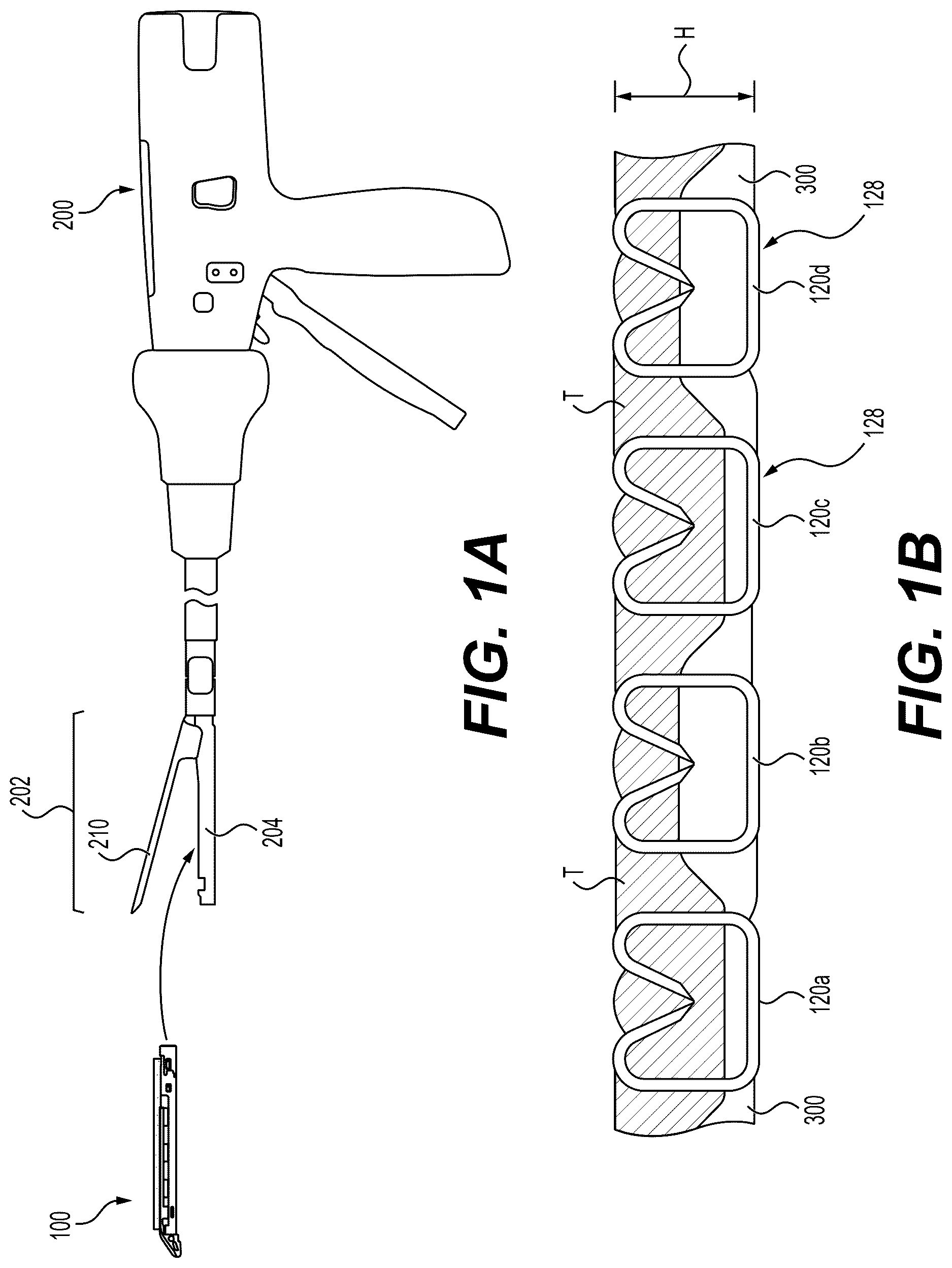 Patent US12616476 Figure 1 – Mechanical fixation of an implantable adjunct to a staple cartridge