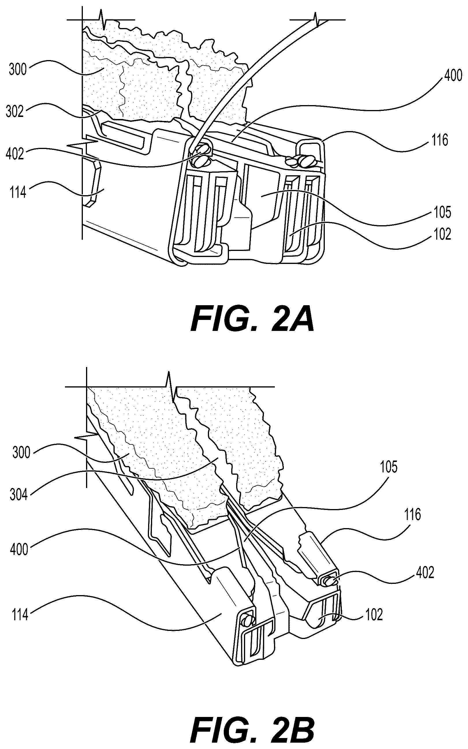 Patent US12616476 Figure 4 – Mechanical fixation of an implantable adjunct to a staple cartridge