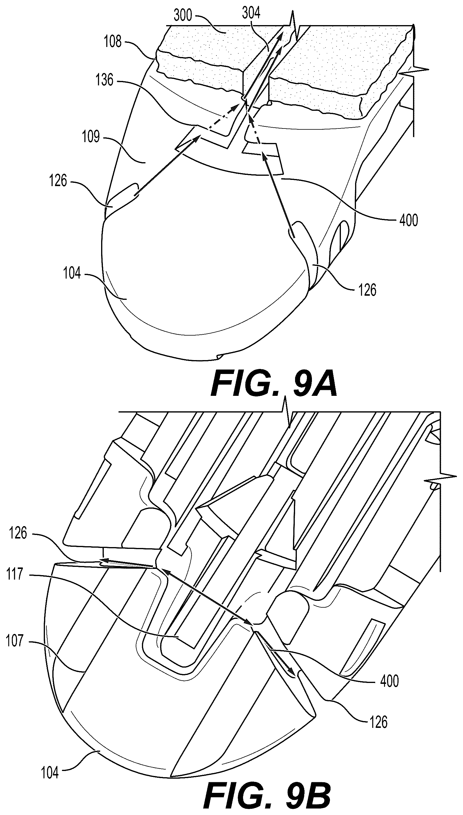 Patent US12616476 Figure 13 – Mechanical fixation of an implantable adjunct to a staple cartridge