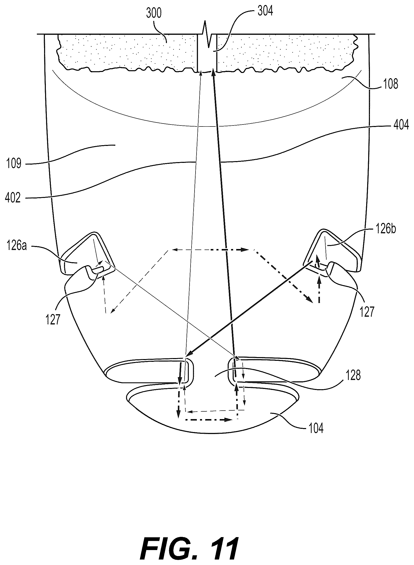 Patent US12616476 Figure 15 – Mechanical fixation of an implantable adjunct to a staple cartridge