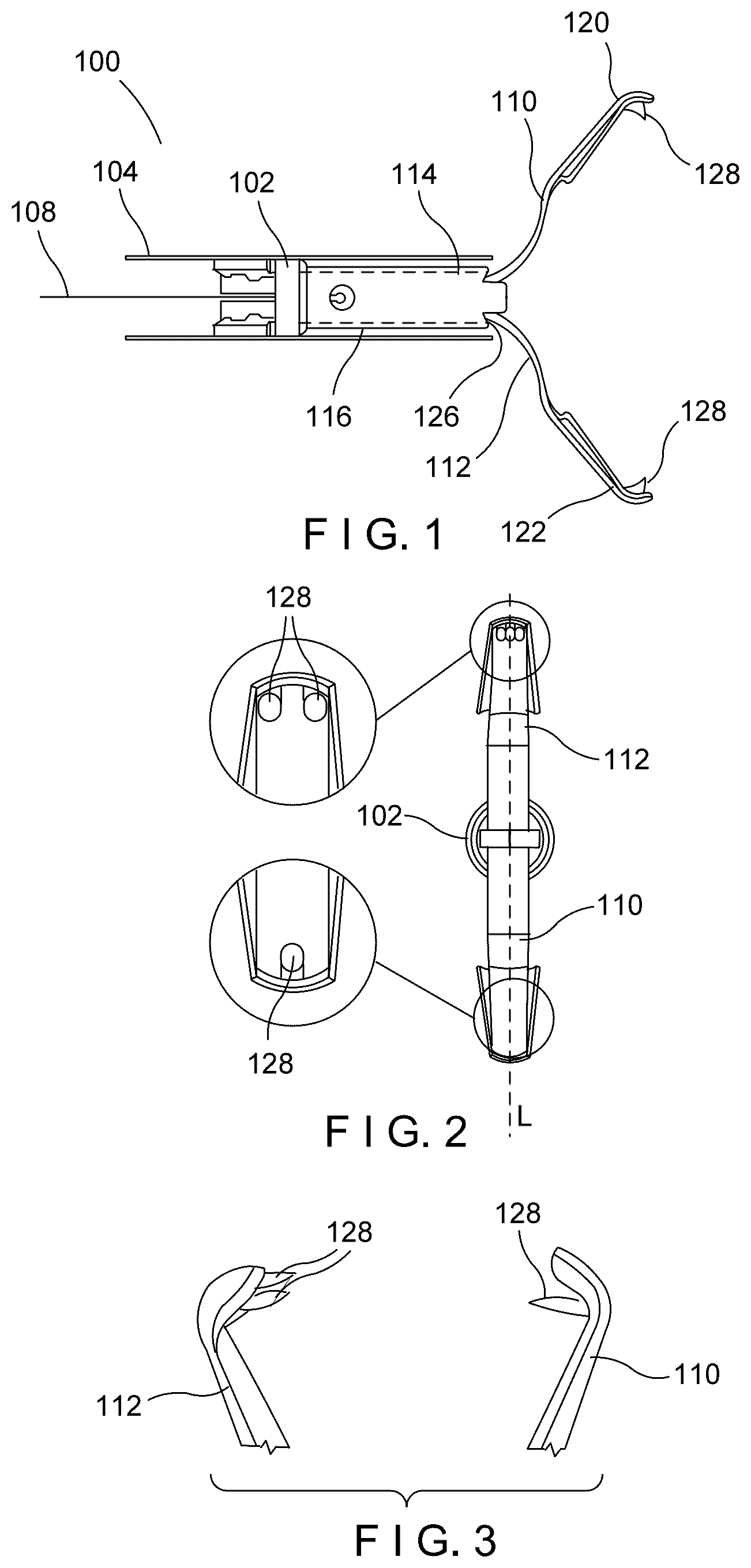 Patent US12616479 Figure 1 – Aggressive featured clips with improved tissue retention