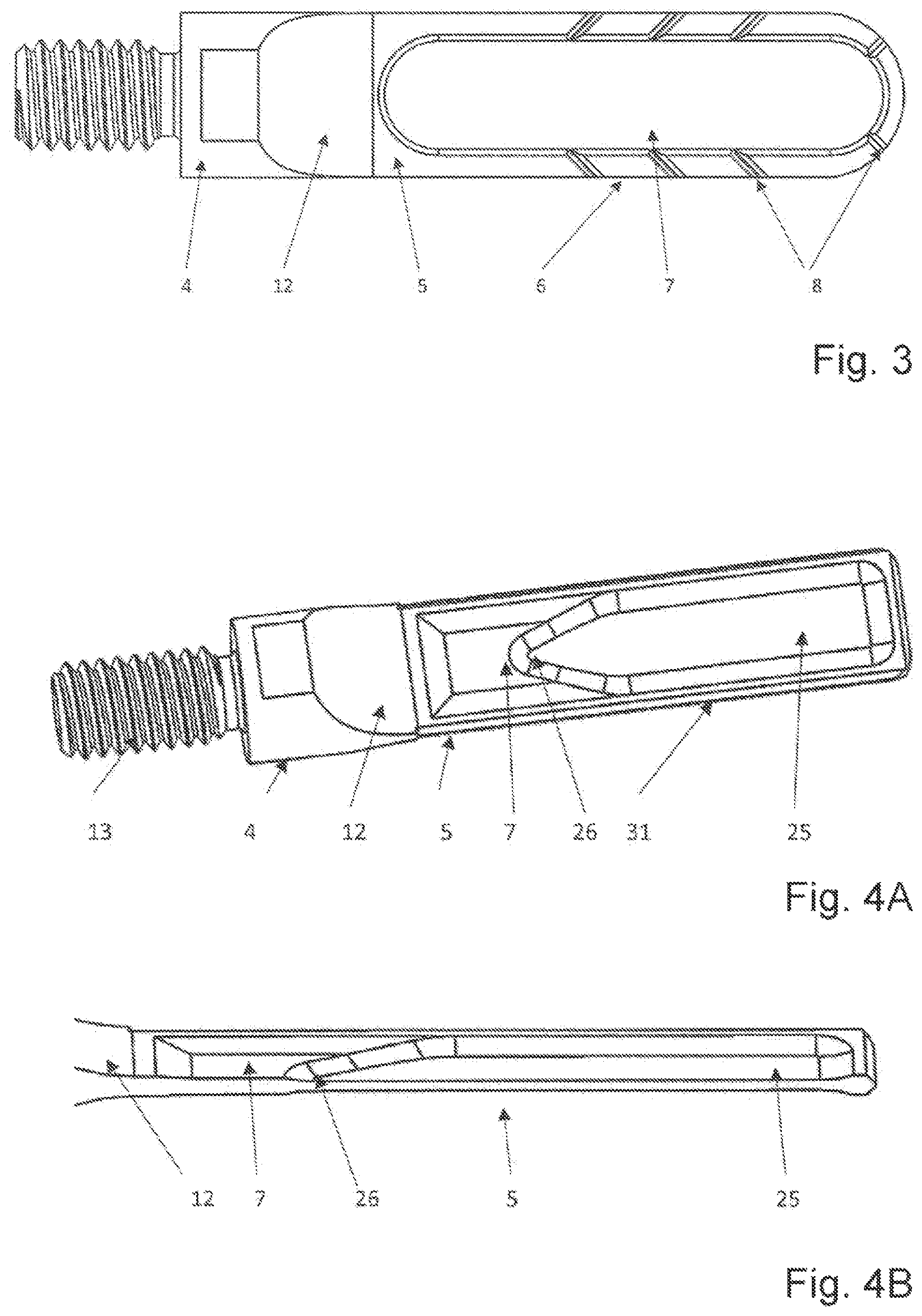 Patent US12616483 Figure 2 – Device and method for perforating a dense bone layer