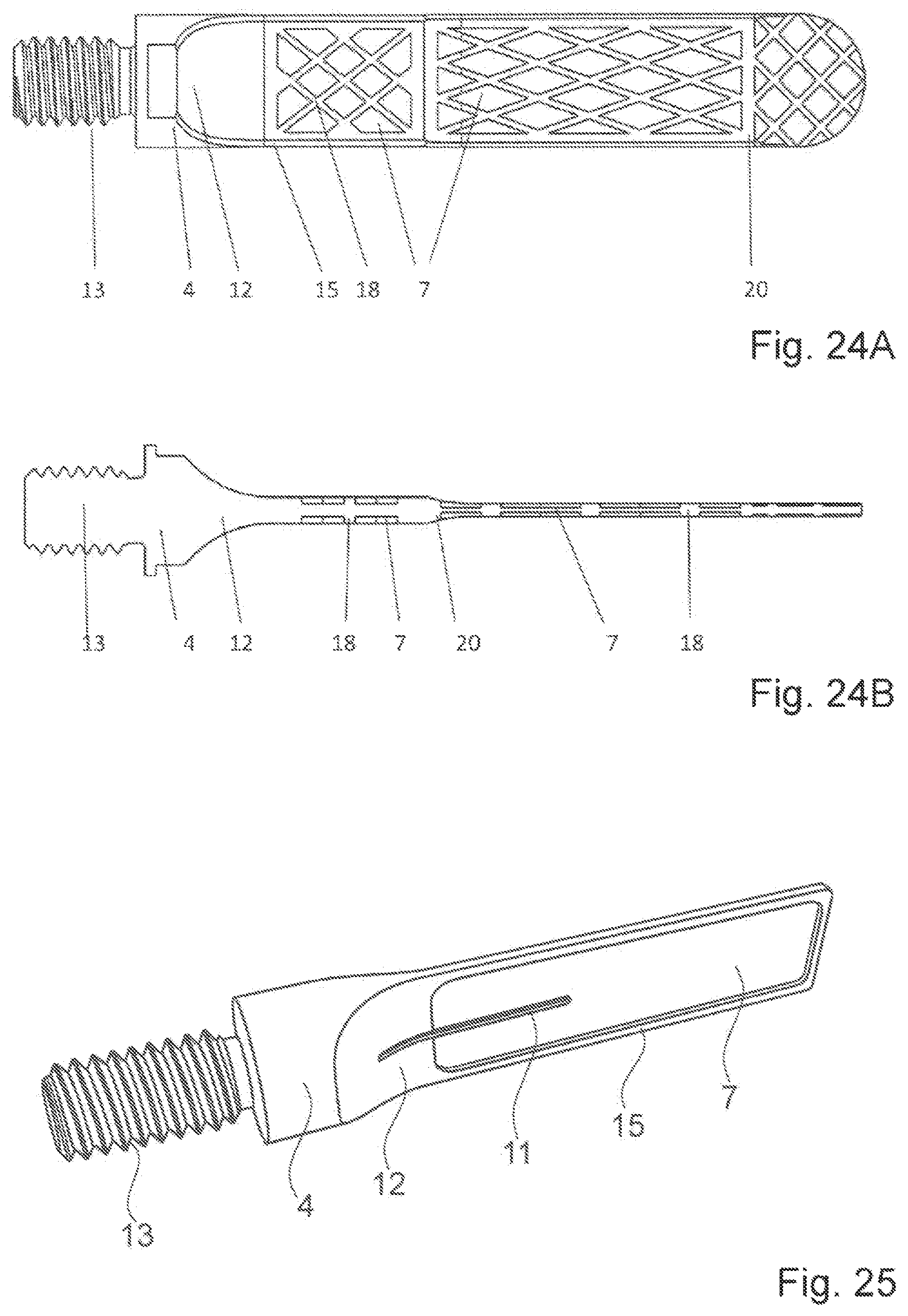 Patent US12616483 Figure 13 – Device and method for perforating a dense bone layer