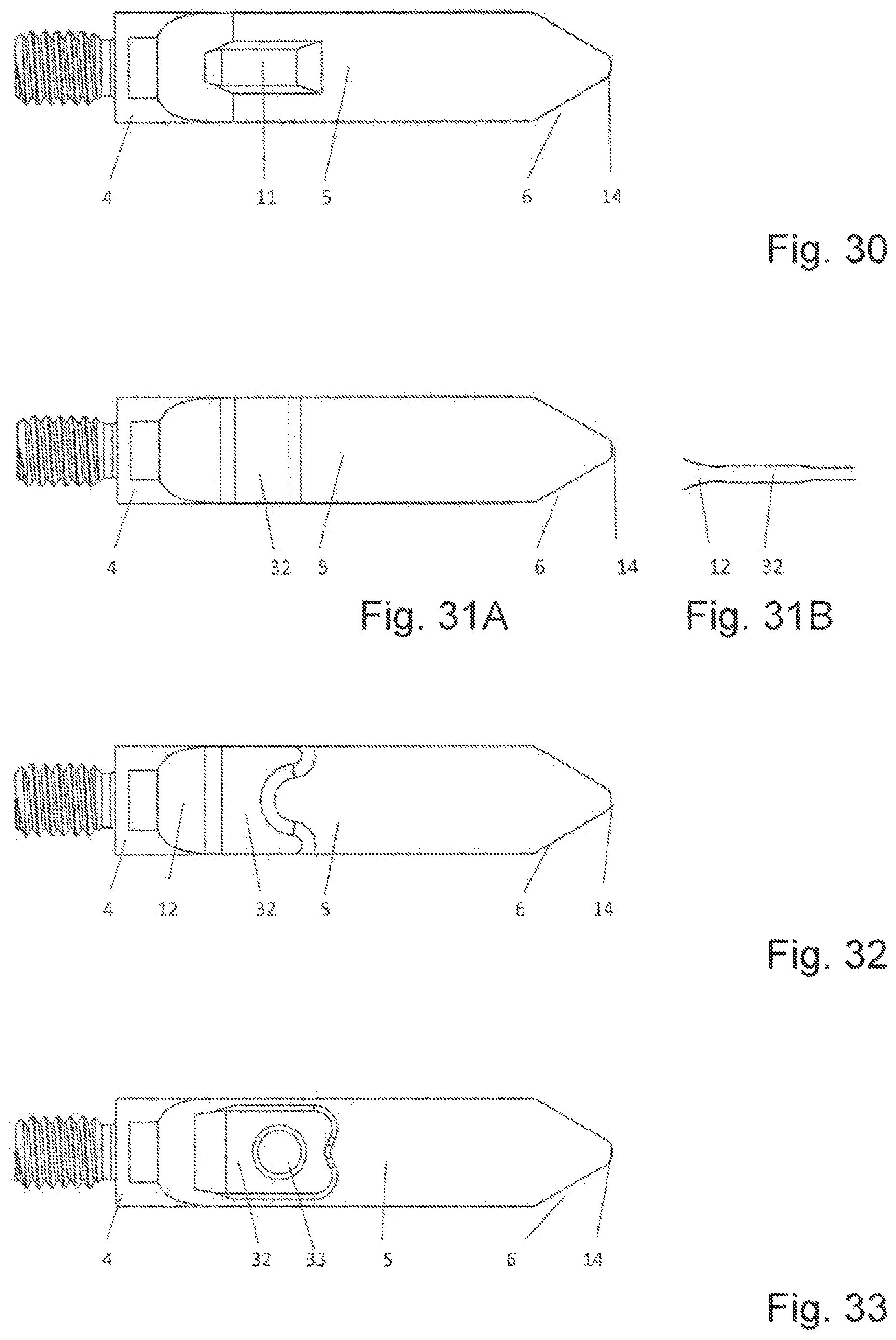 Patent US12616483 Figure 15 – Device and method for perforating a dense bone layer