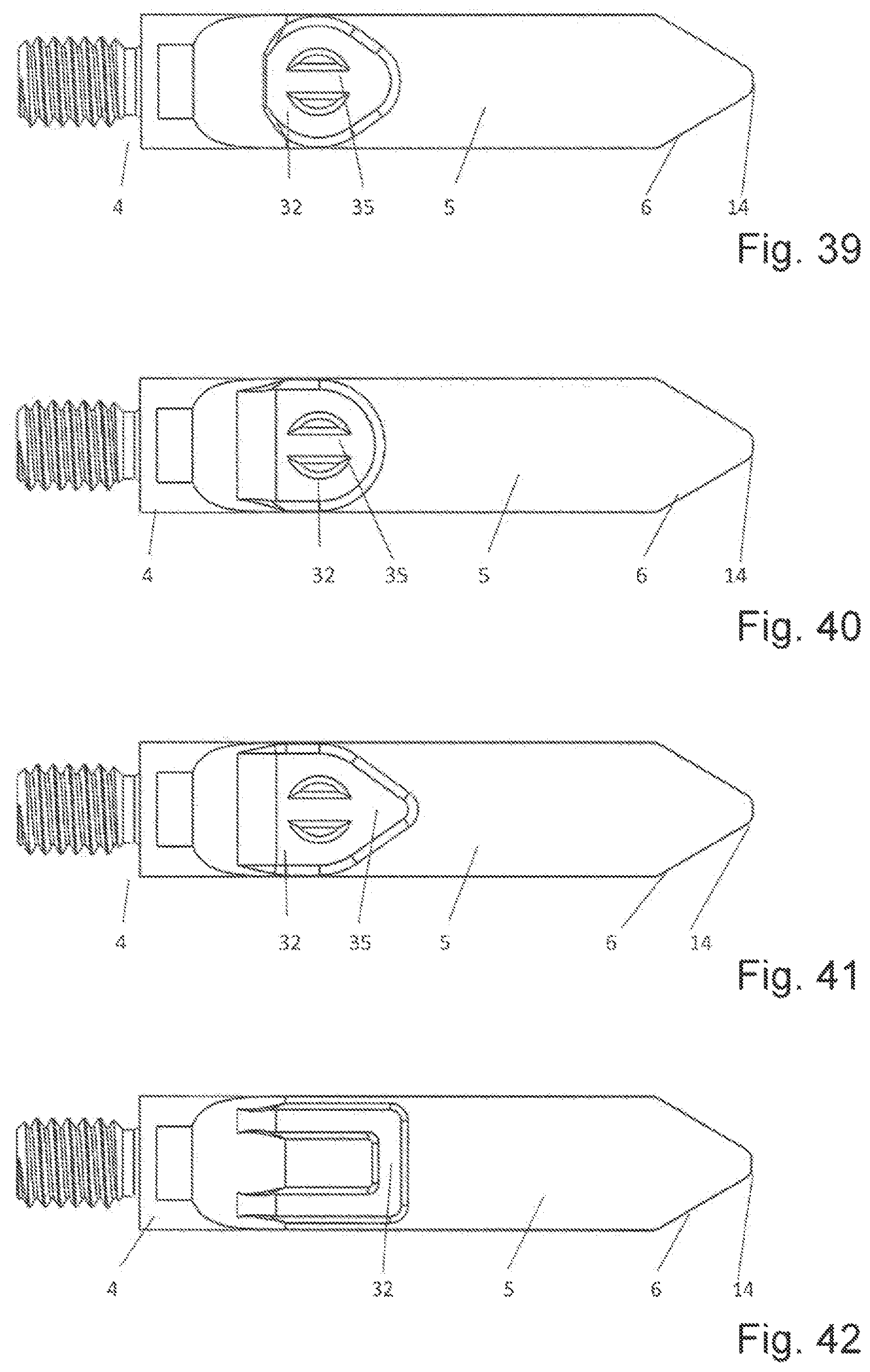 Patent US12616483 Figure 17 – Device and method for perforating a dense bone layer