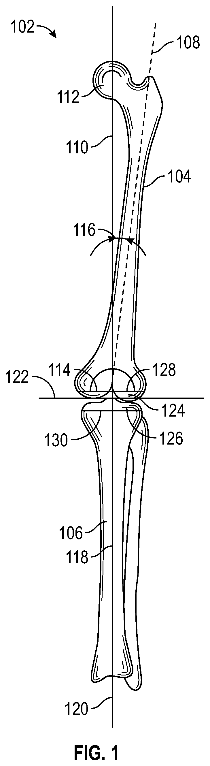 Patent US12616486 Figure 1 – Systems, methods, and apparatuses for tibial mechanical axis digitization