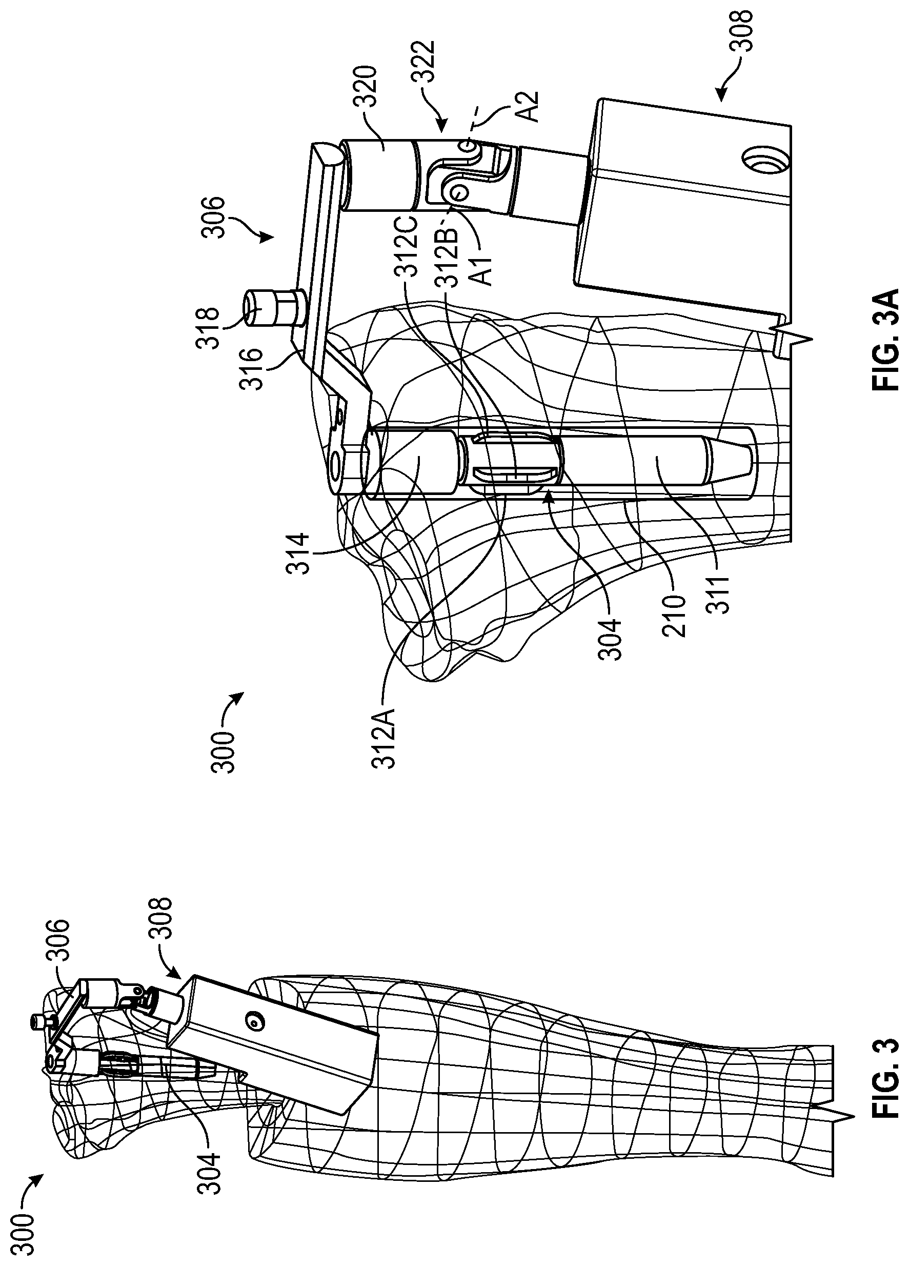 Patent US12616486 Figure 3 – Systems, methods, and apparatuses for tibial mechanical axis digitization