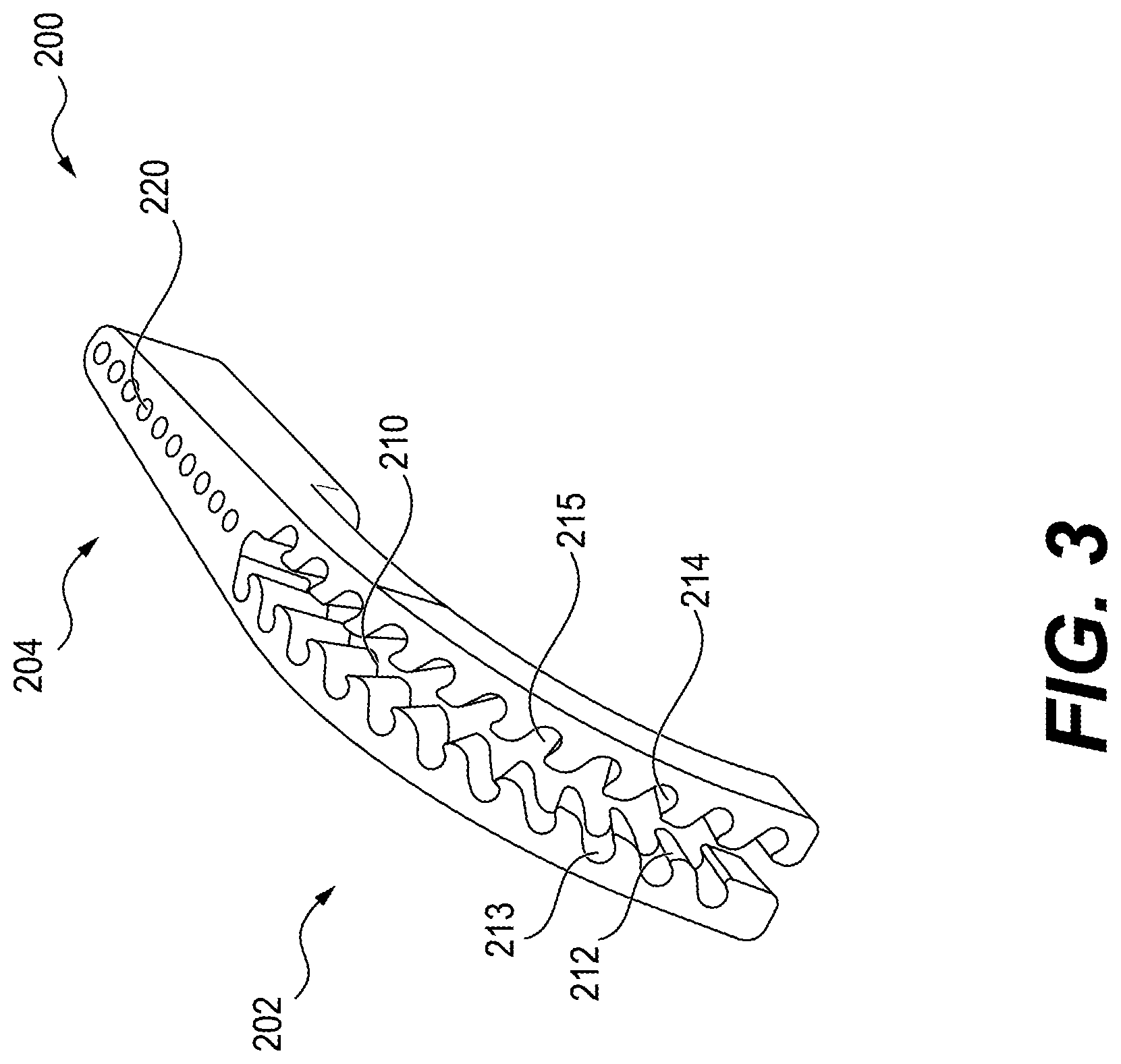 Patent US12616487 Figure 3 – Minimally invasive surgery lapidus system