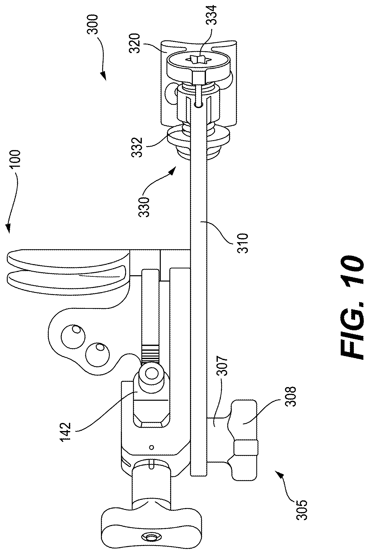 Patent US12616487 Figure 9 – Minimally invasive surgery lapidus system